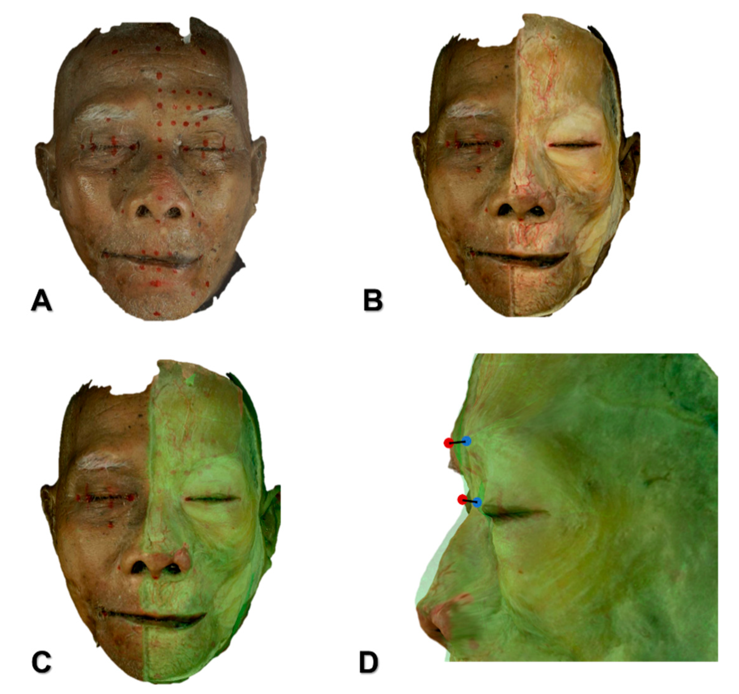 Toxins 11 00560 g004