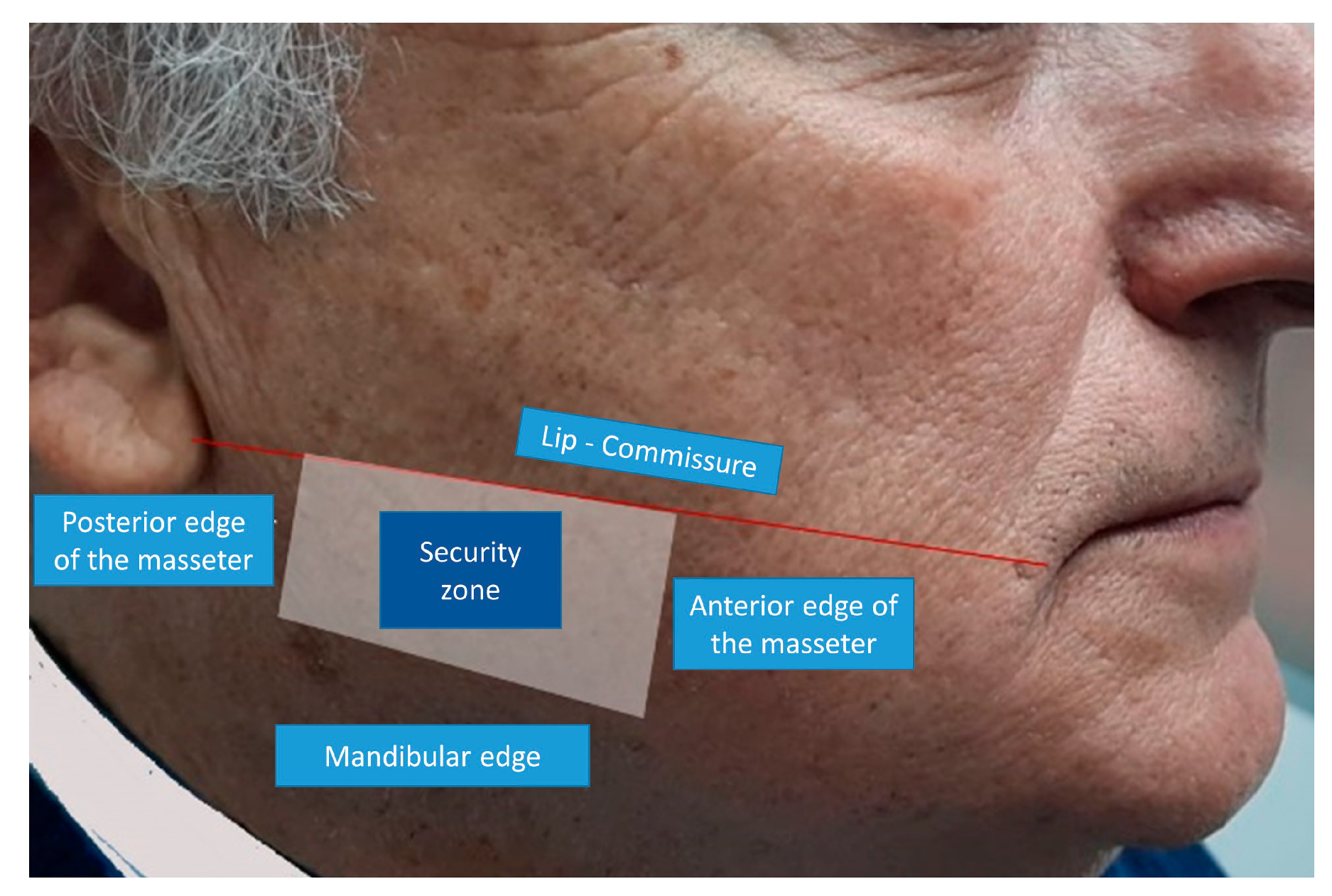 Toxins 12 00112 g001 Toxins 12 00112 g001