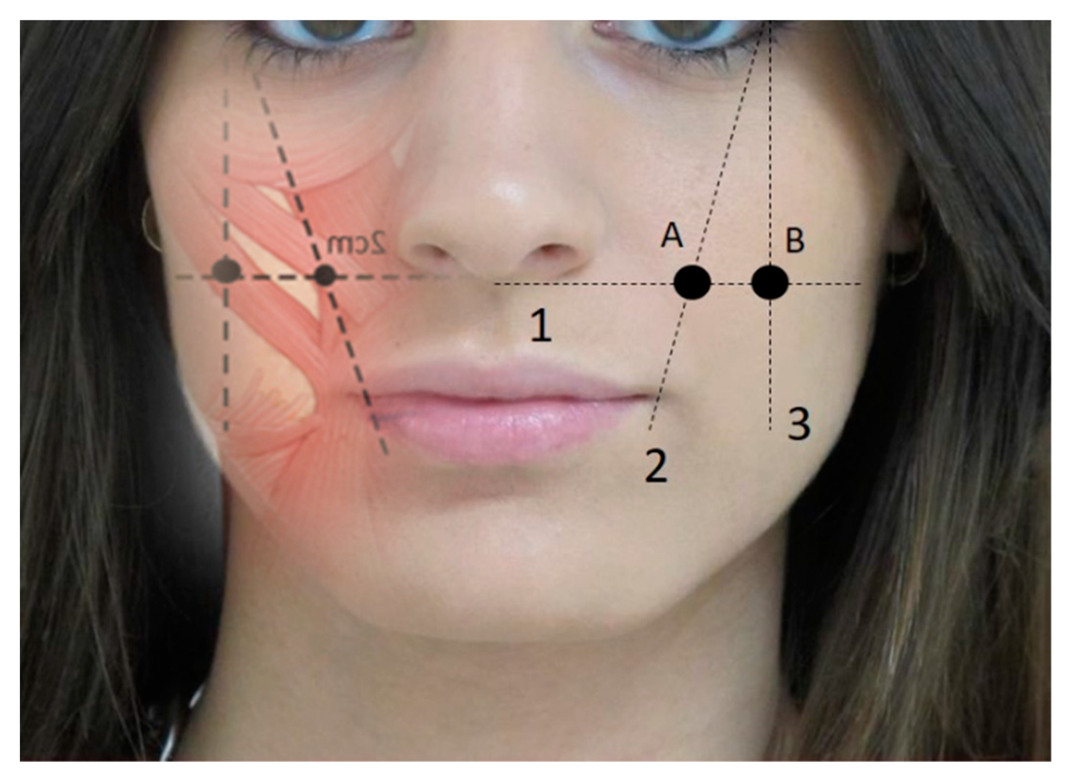 Toxins 12 00112 g002 Toxins 12 00112 g002