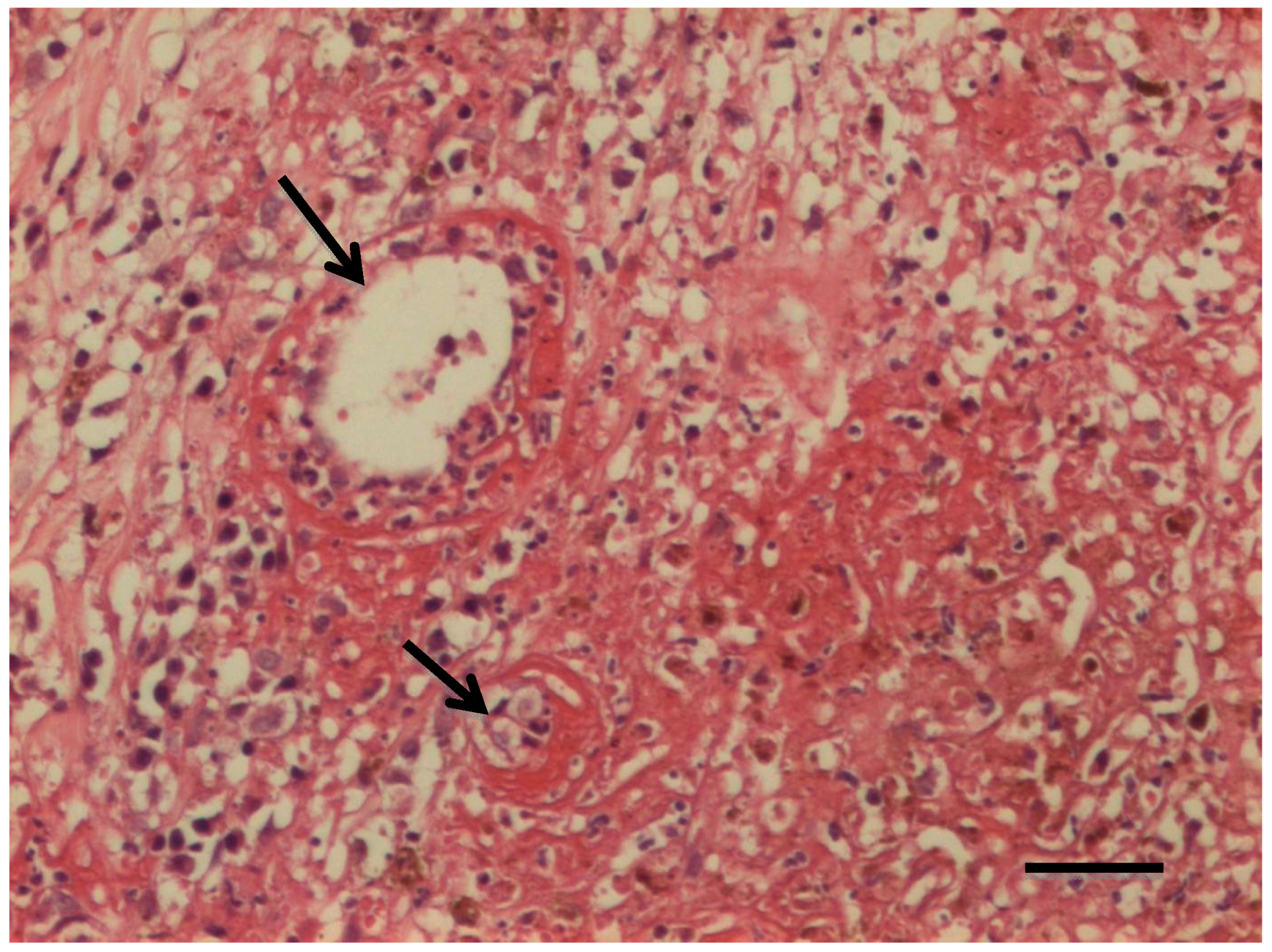 Toxins 12 00157 g003