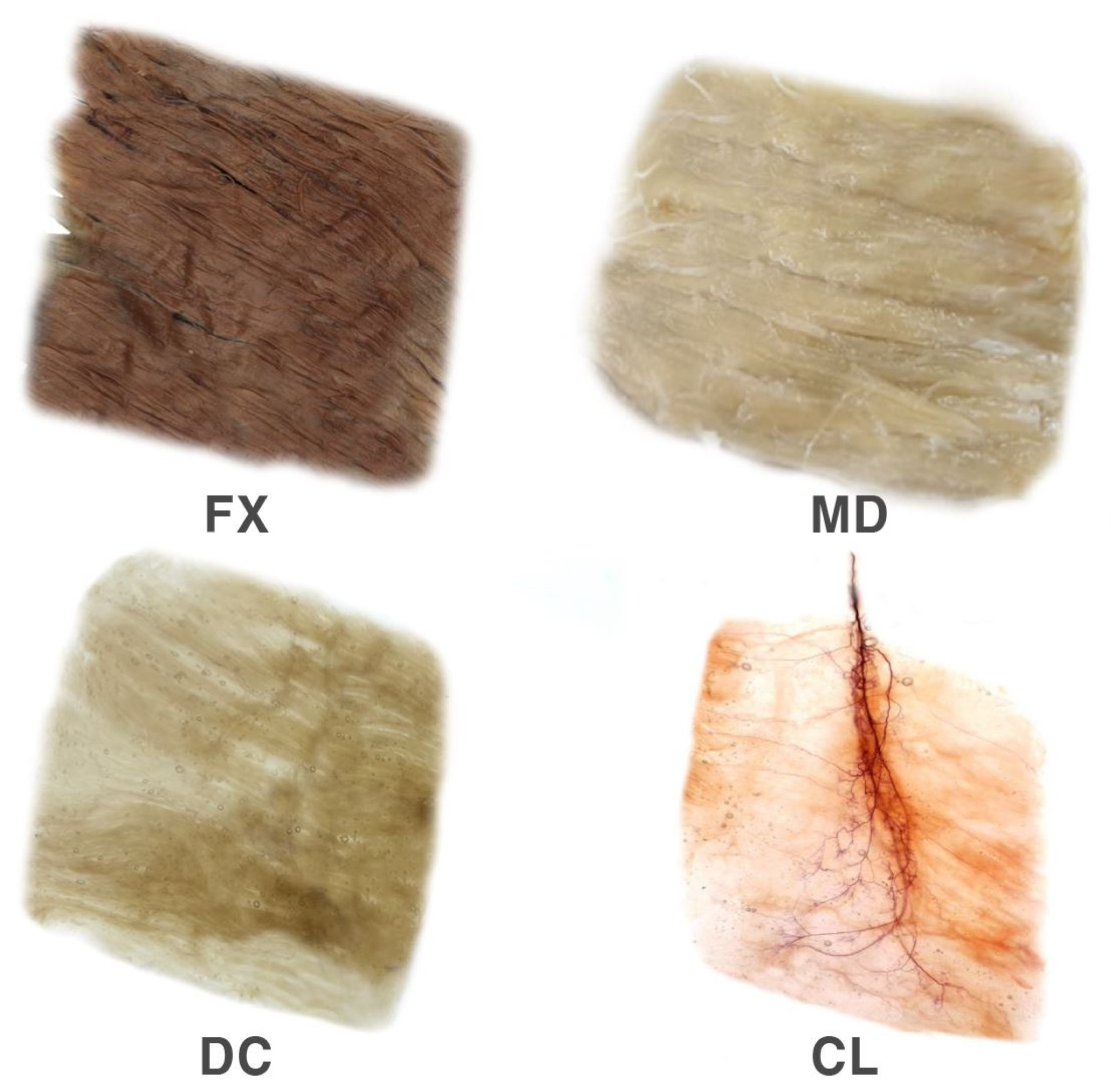 Toxins 12 00289 g004