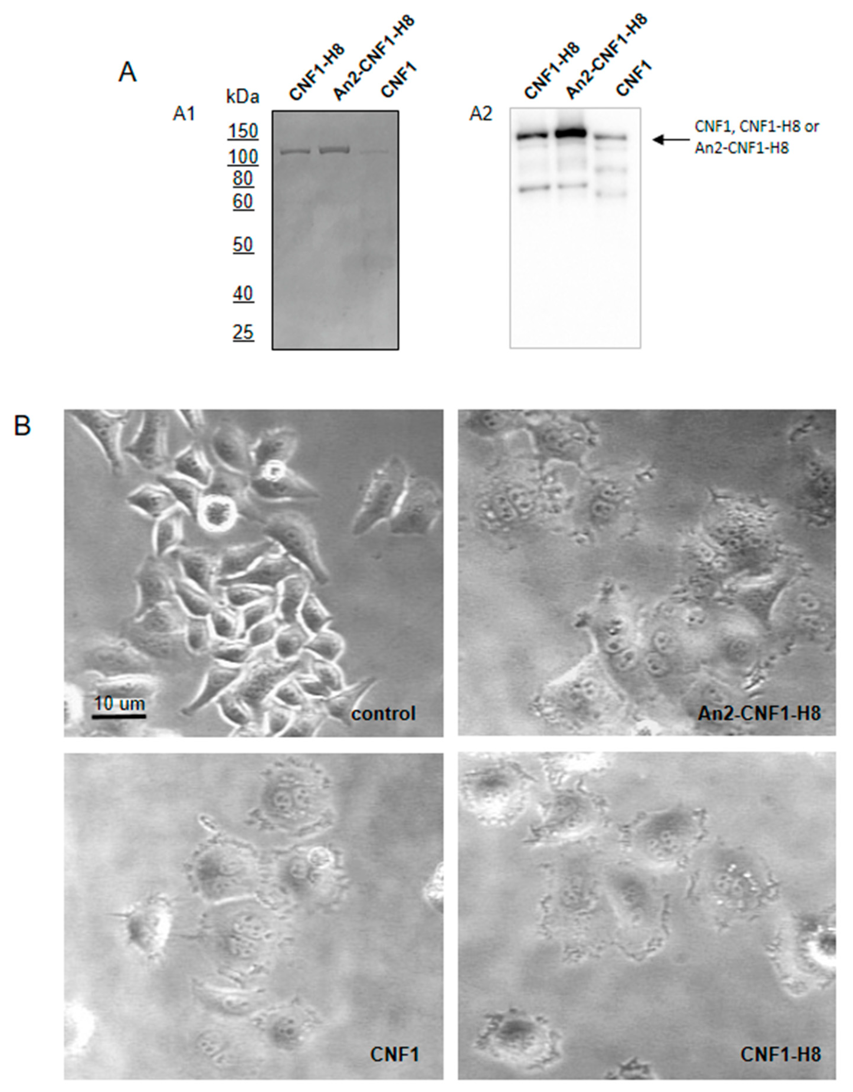 Toxins 12 00291 g002