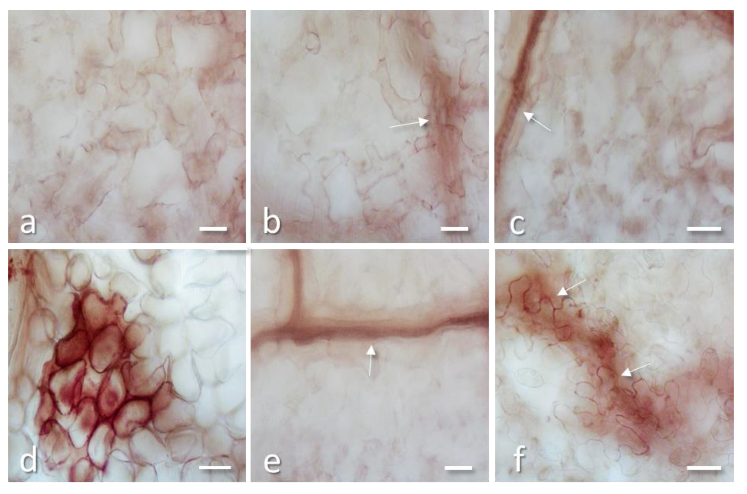 Toxins 12 00524 g006
