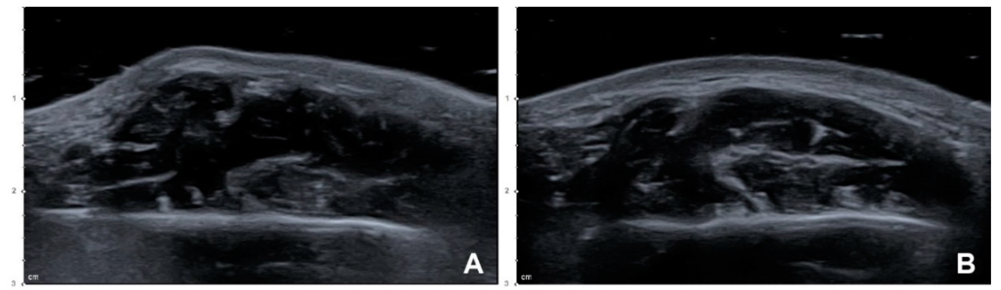 Toxins 12 00588 g002