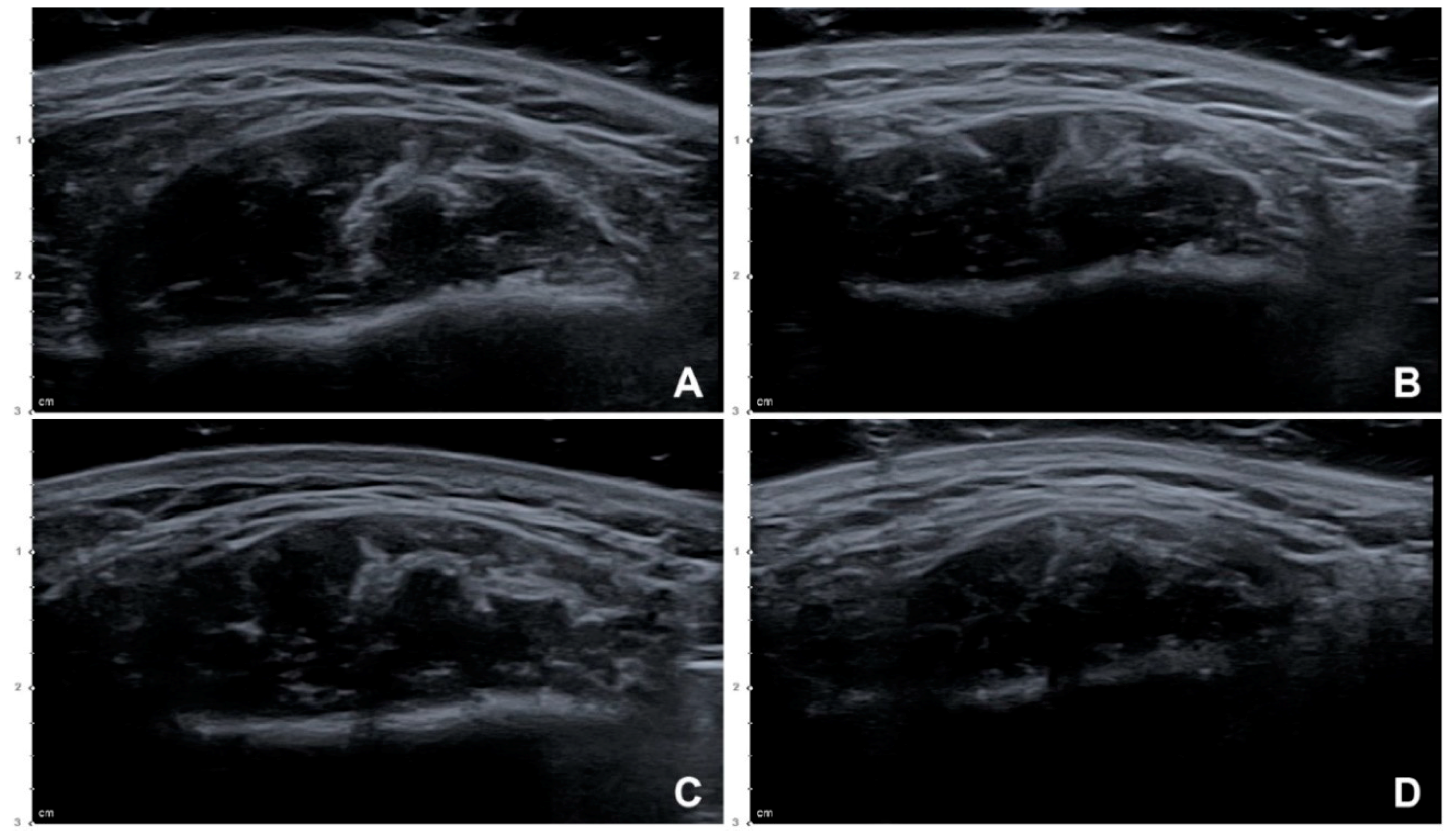 Toxins 12 00588 g003