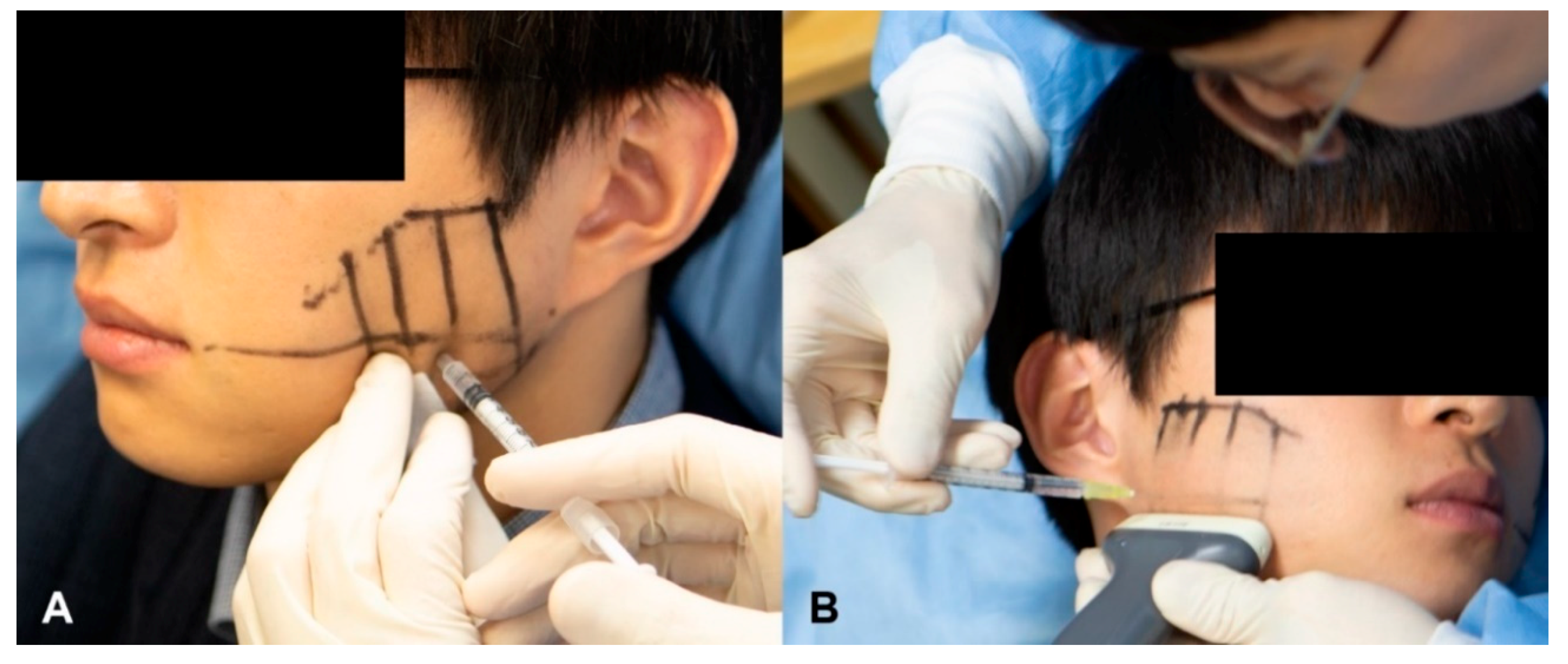 Toxins 12 00588 g005