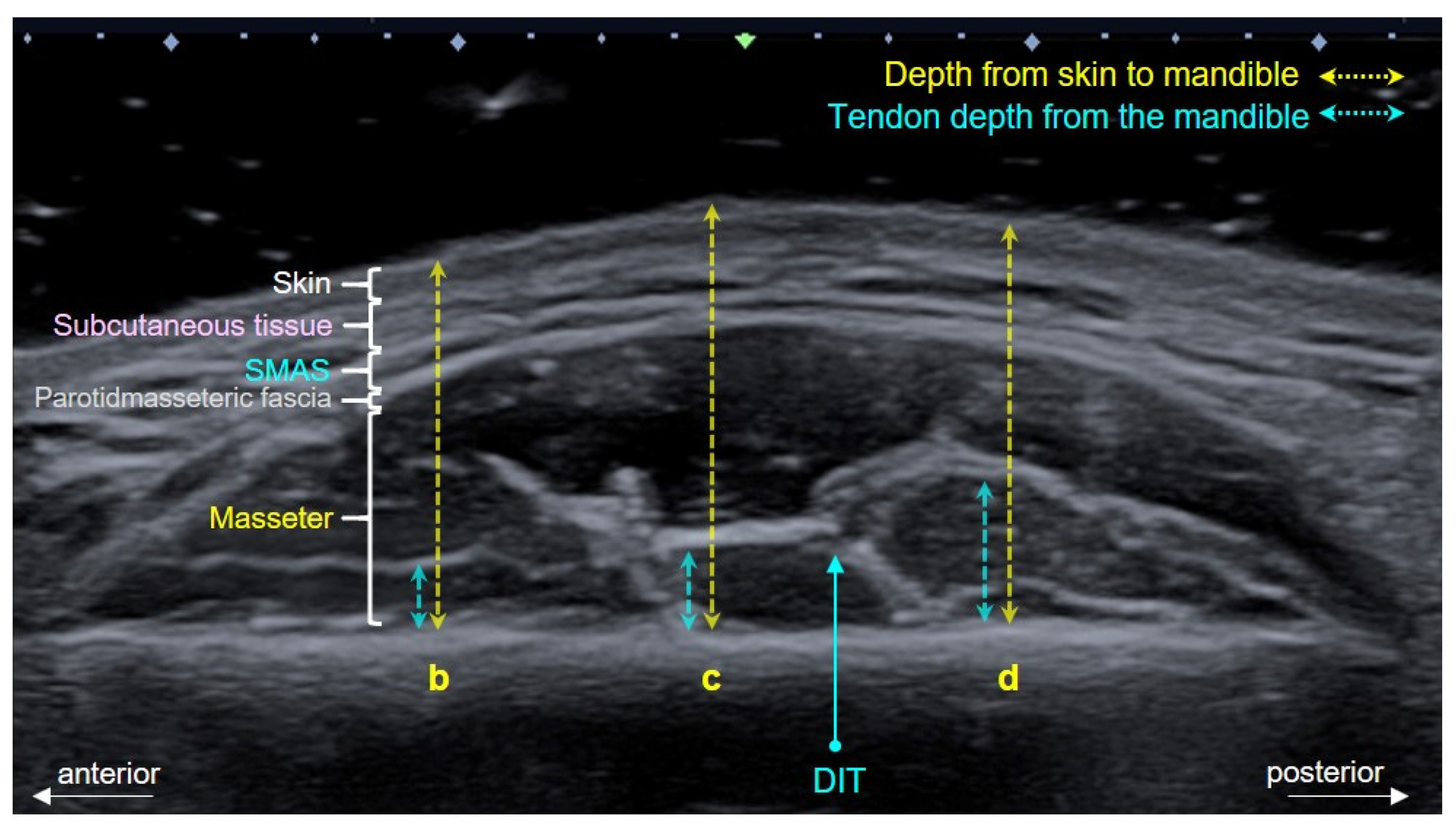 Toxins 13 00028 g005