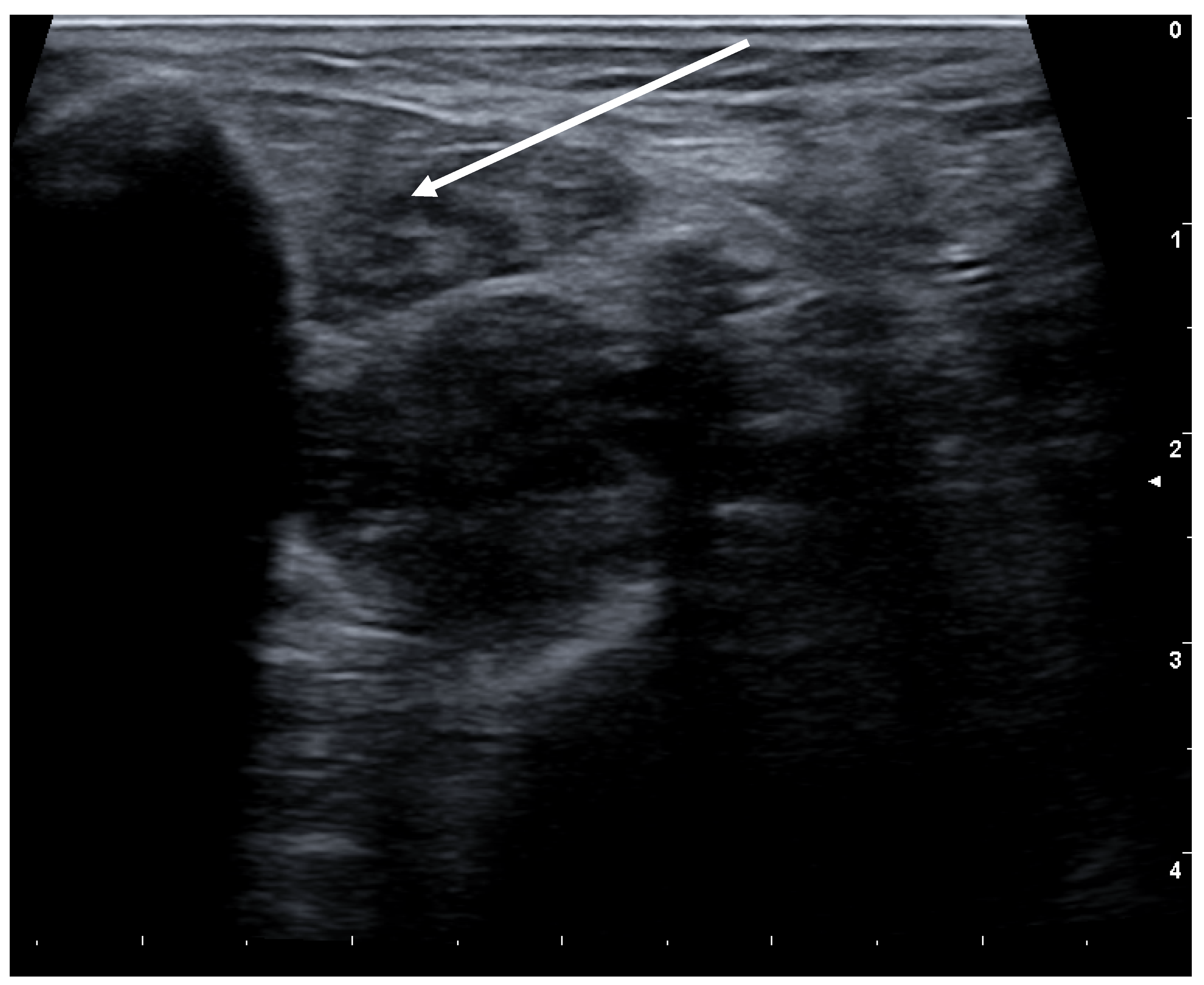 Toxins 13 00087 g004