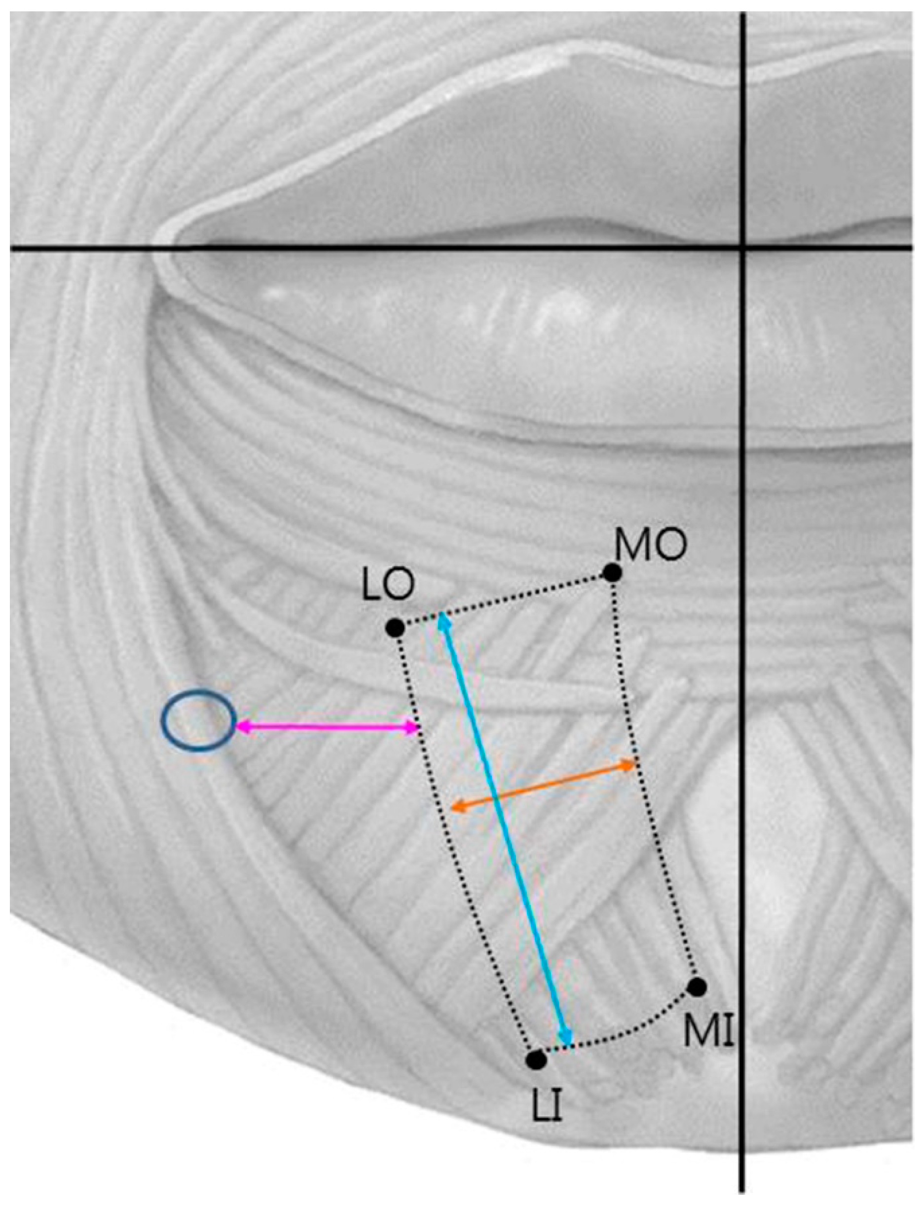 Toxins 13 00096 g006