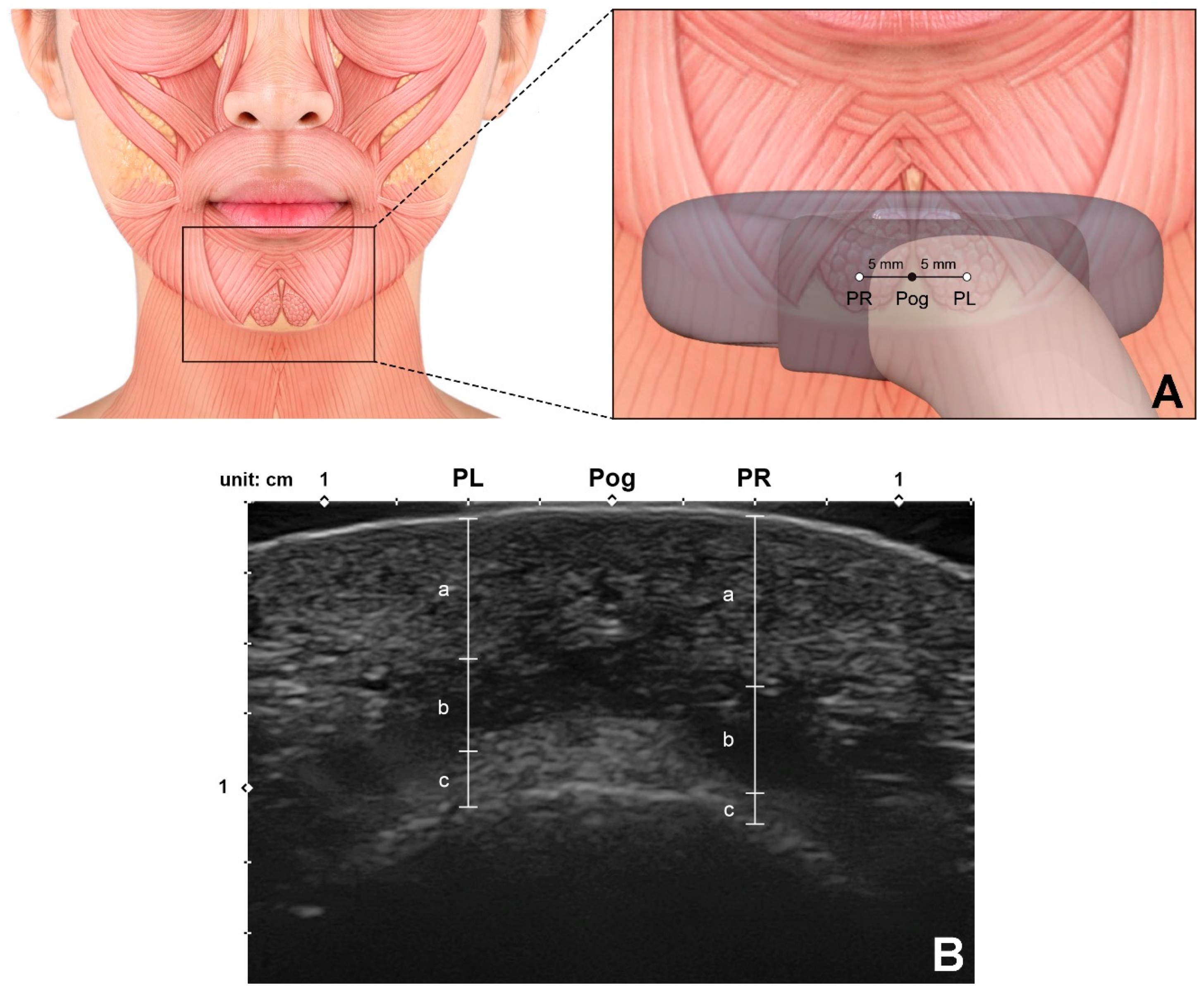 Toxins 13 00096 g007