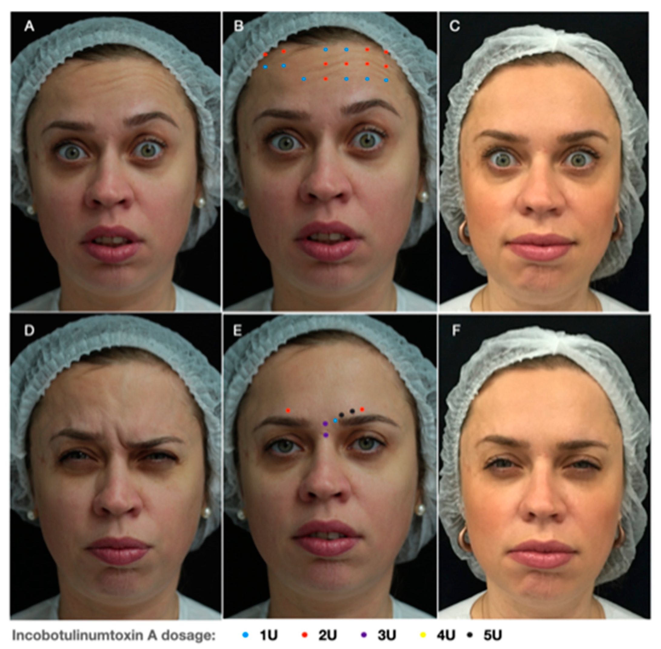 Toxins 13 00159 g002 Toxins 13 00159 g002