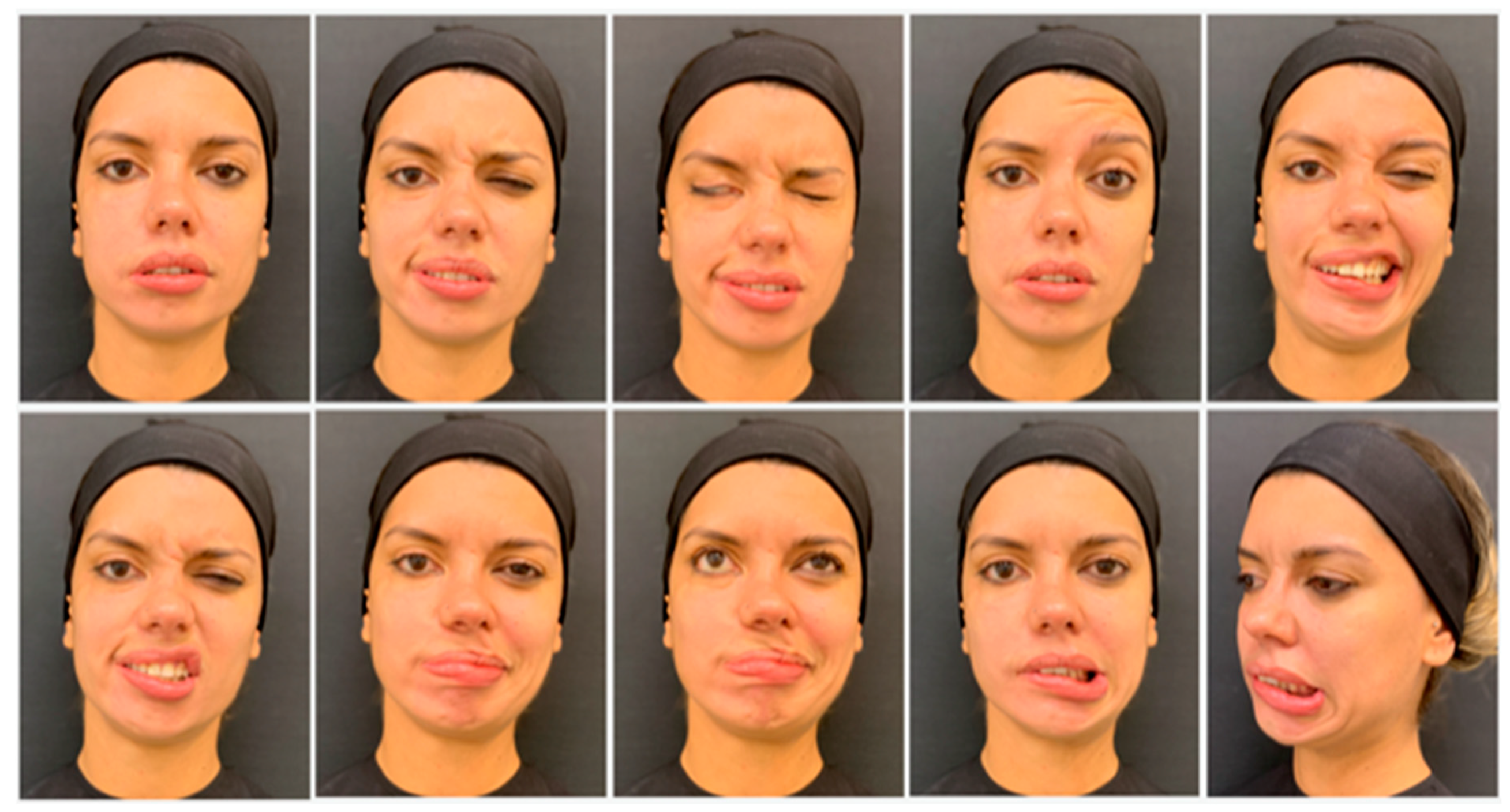 Toxins 13 00159 g003 Toxins 13 00159 g003