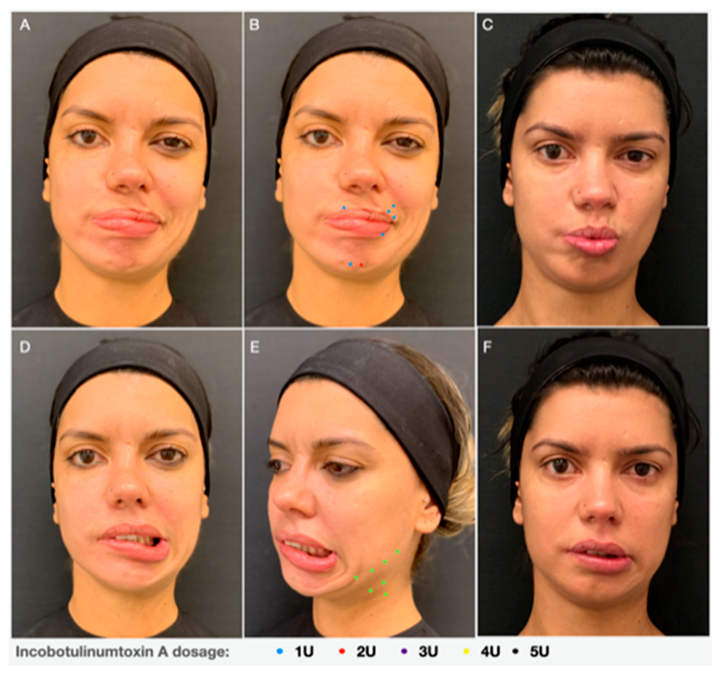 Toxins 13 00159 g005 Toxins 13 00159 g005