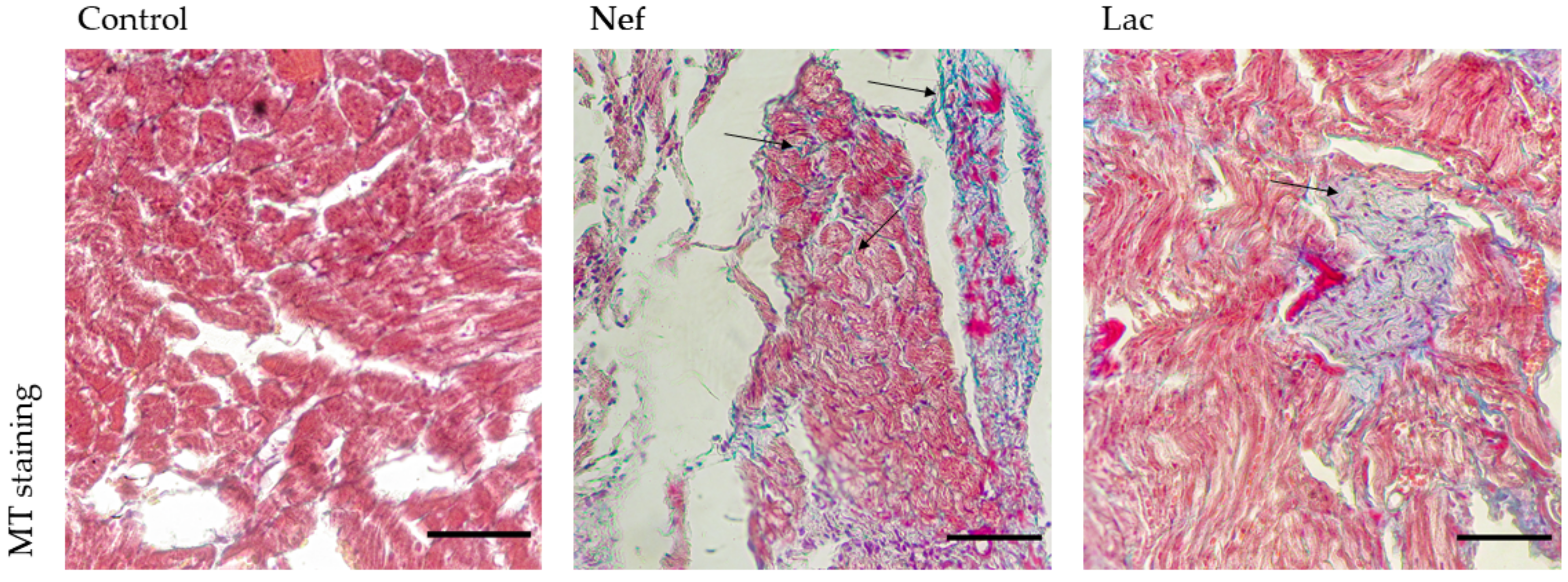 Toxins 13 00192 g005