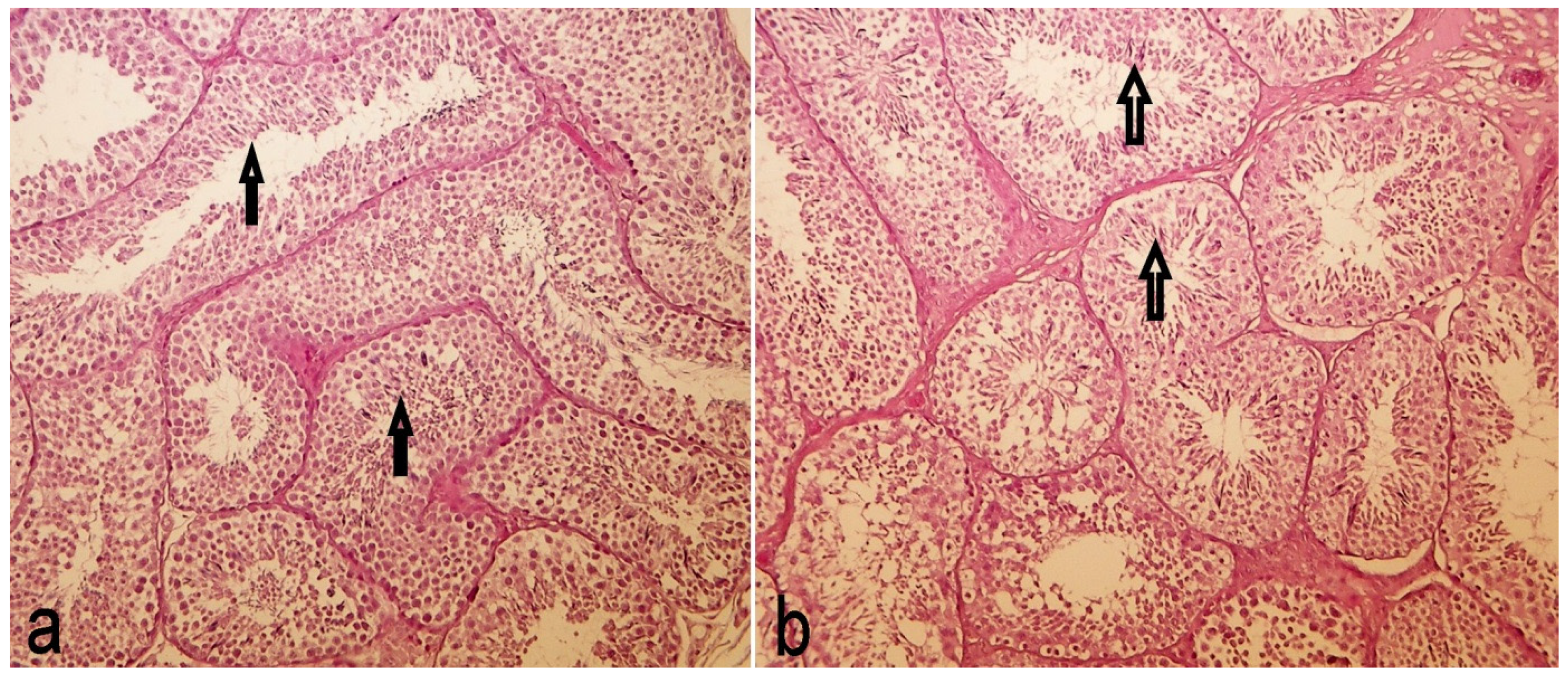 Toxins 13 00237 g009