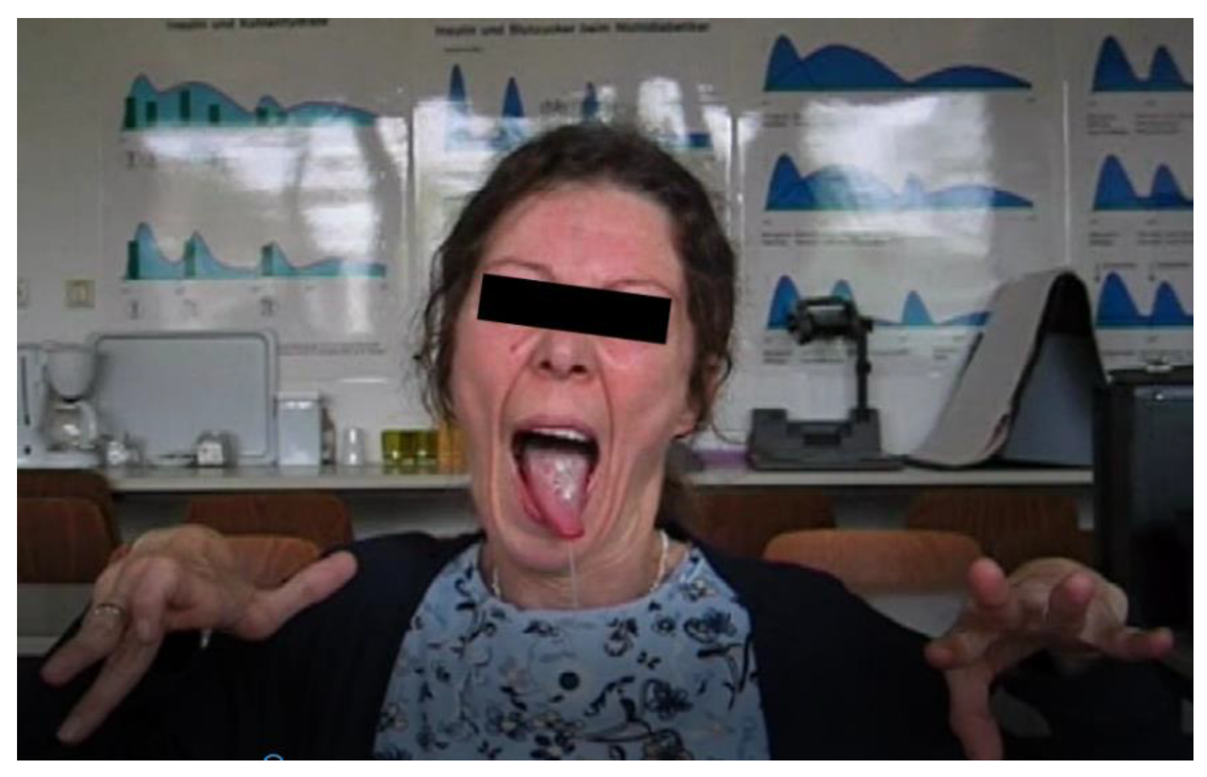 Toxins 13 00241 g002