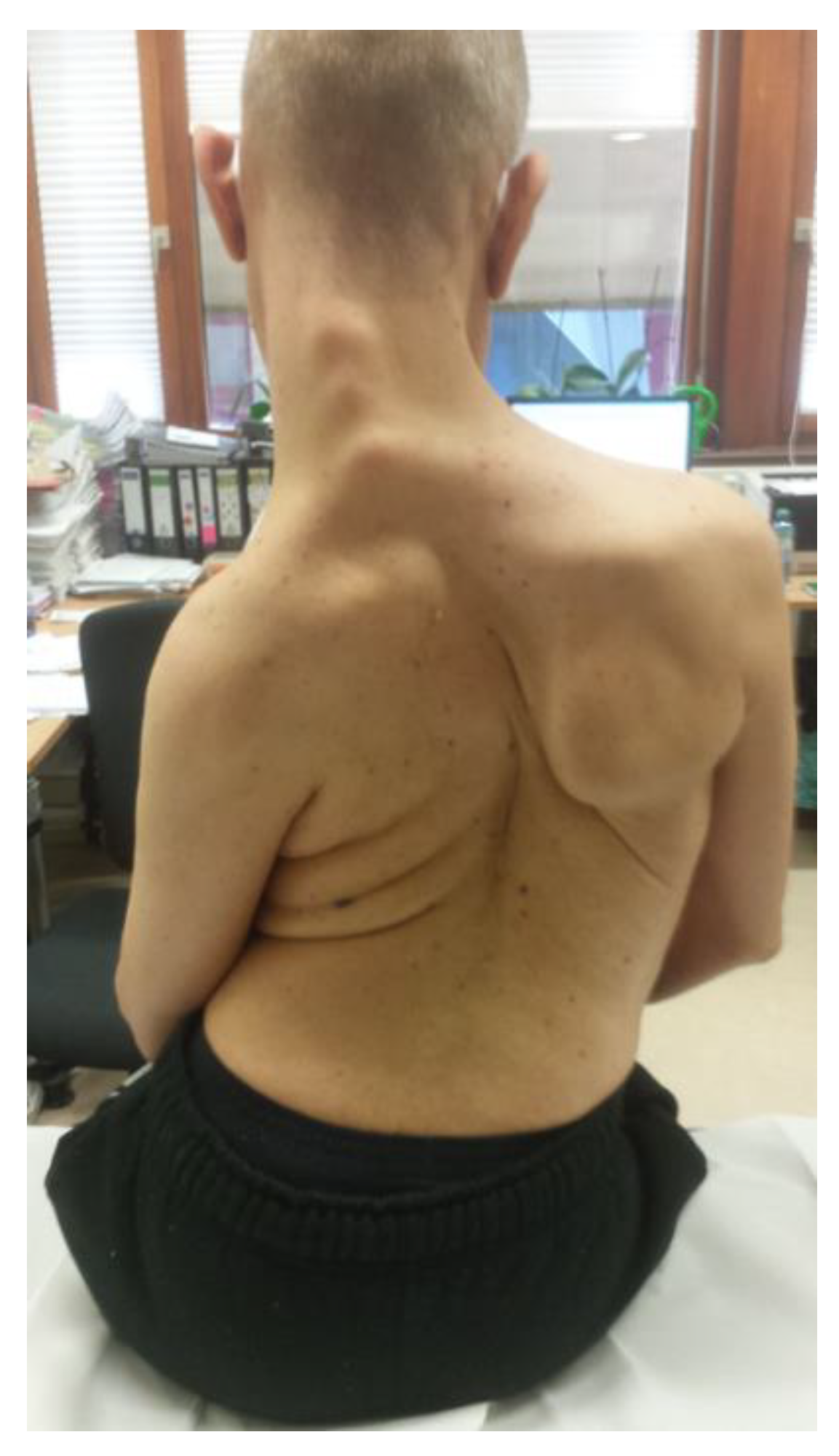 Toxins 13 00241 g003