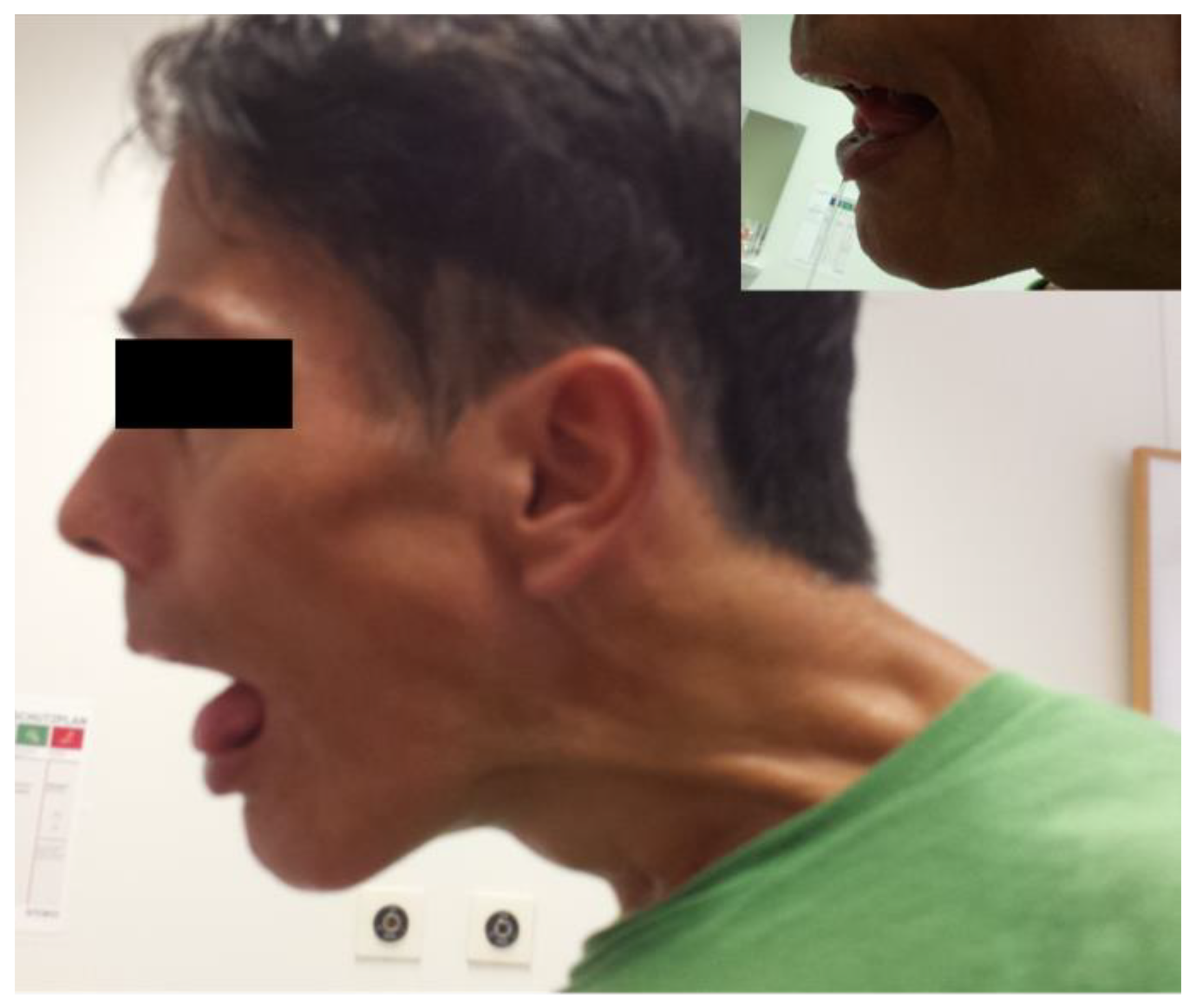 Toxins 13 00241 g004