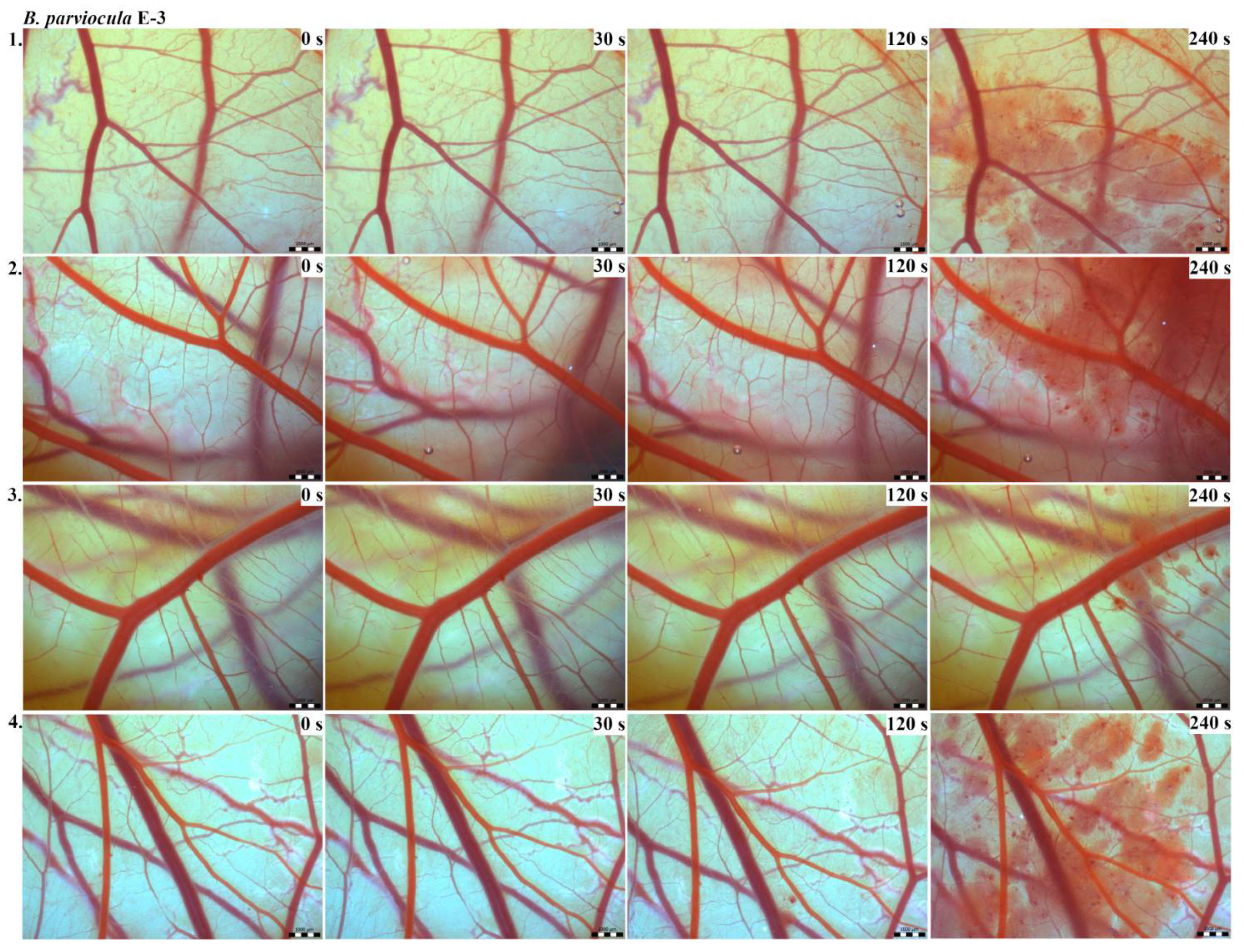 Toxins 13 00299 g004