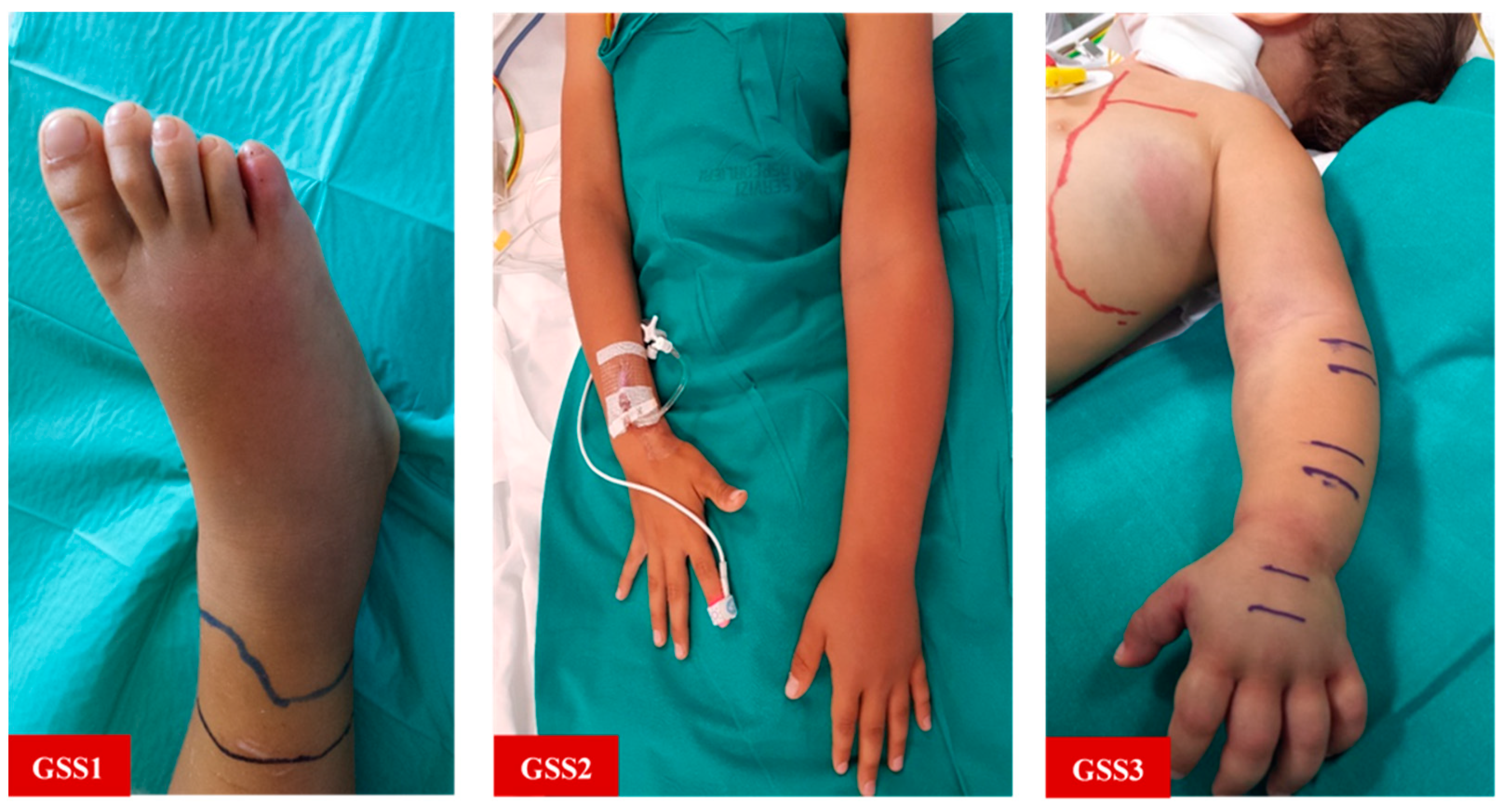 Toxins 13 00330 g003