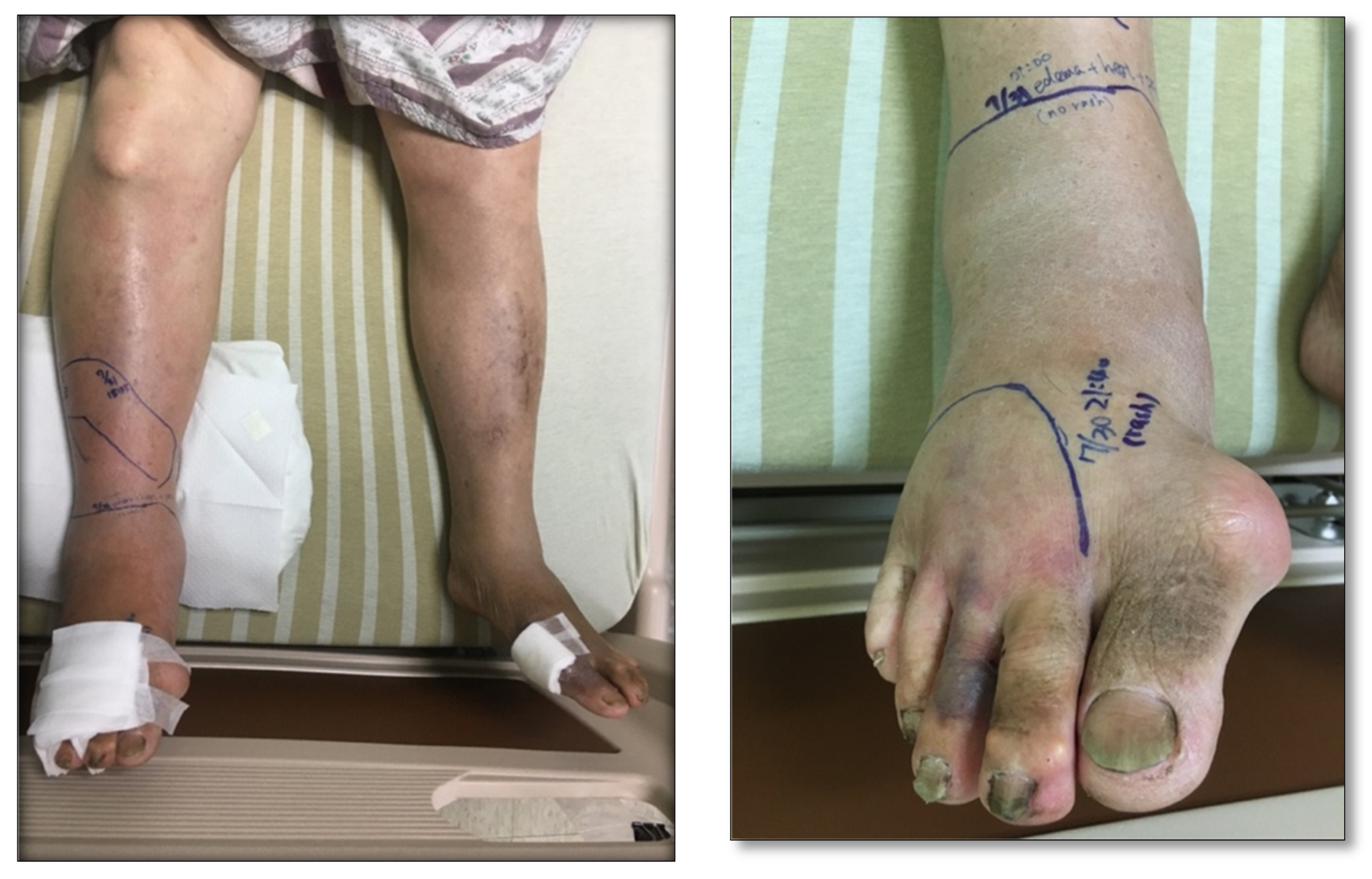 Toxins 13 00338 g001