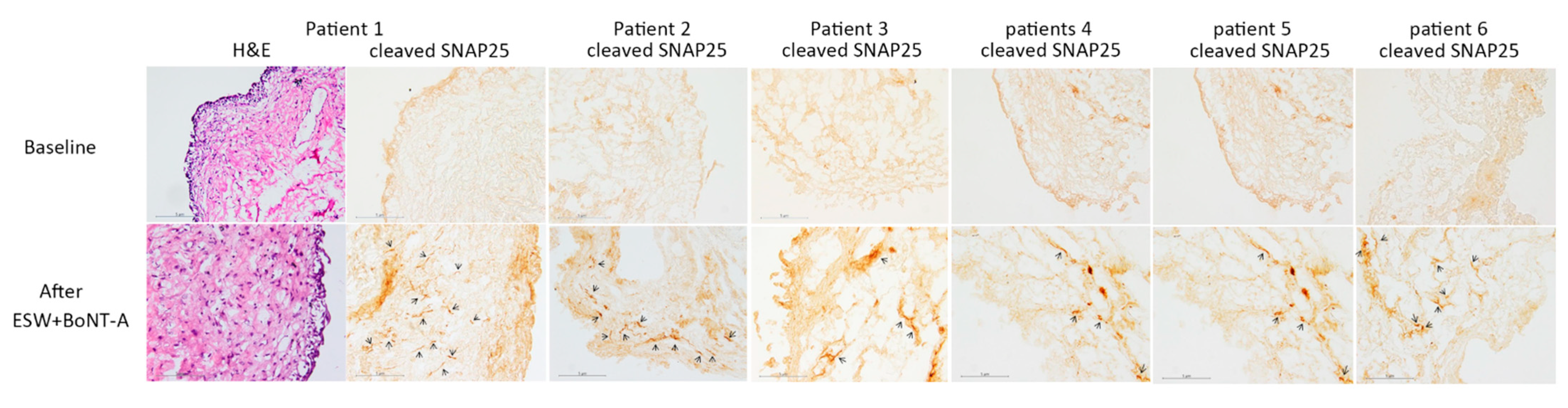 Toxins 13 00359 g001