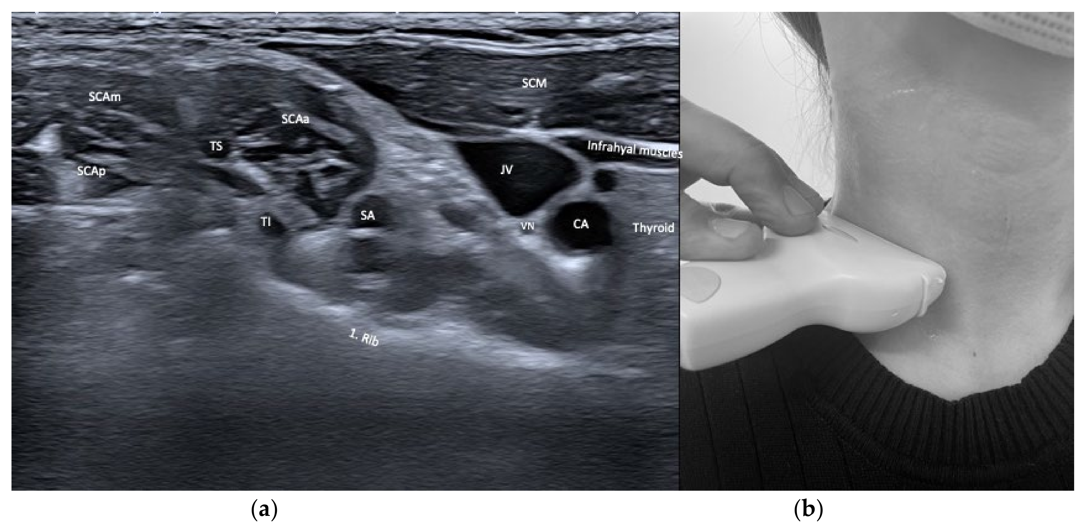 Toxins 13 00365 g004