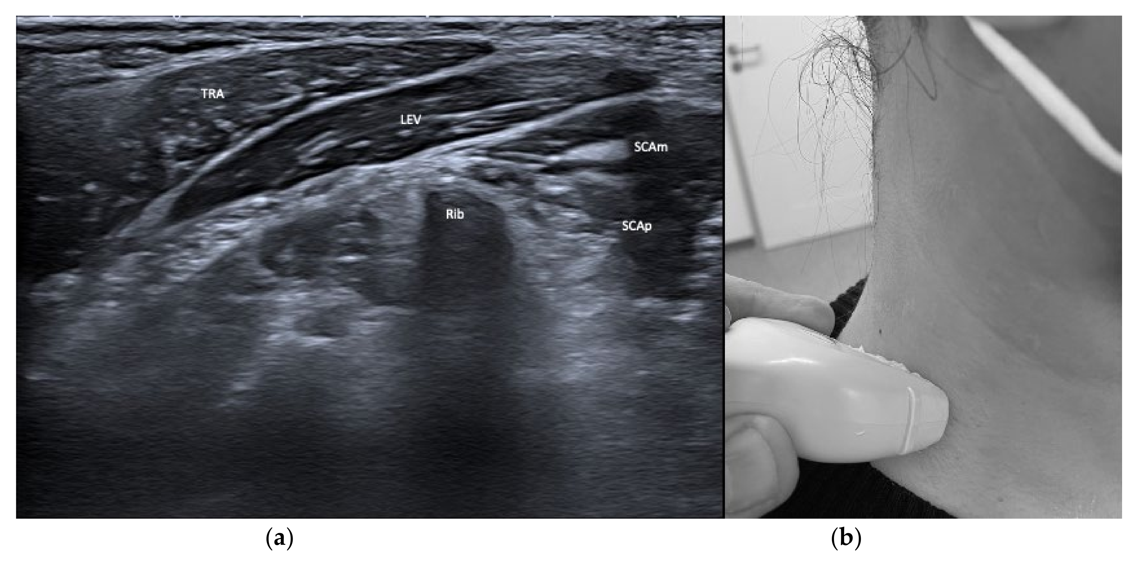 Toxins 13 00365 g005