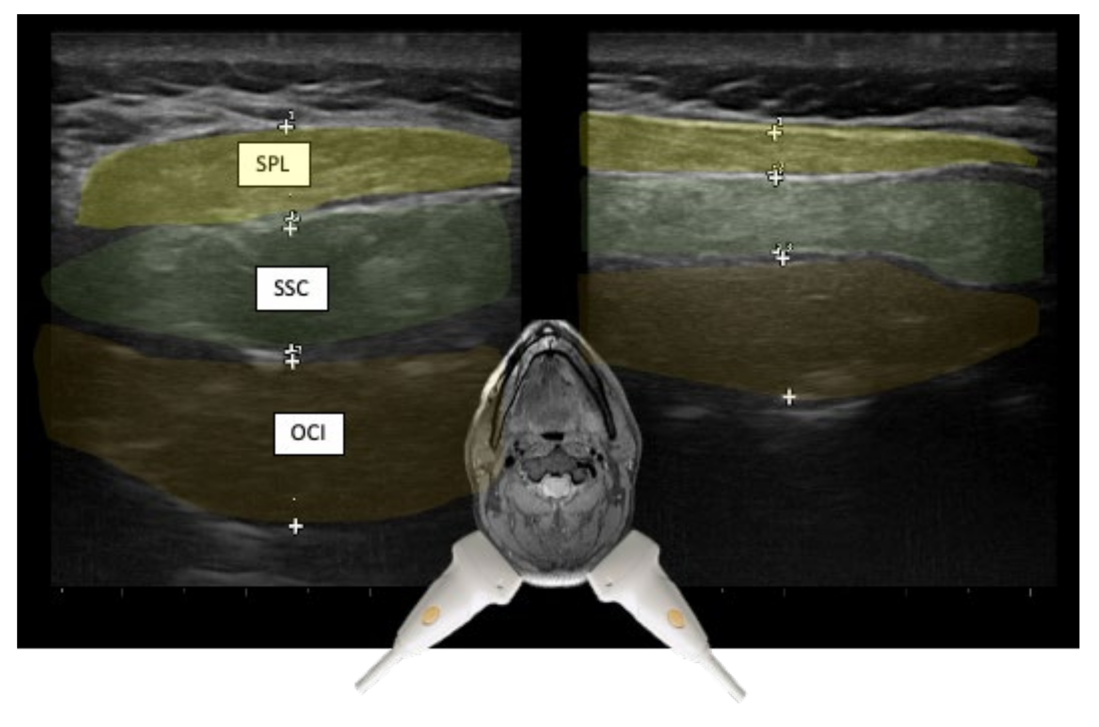 Toxins 13 00365 g007
