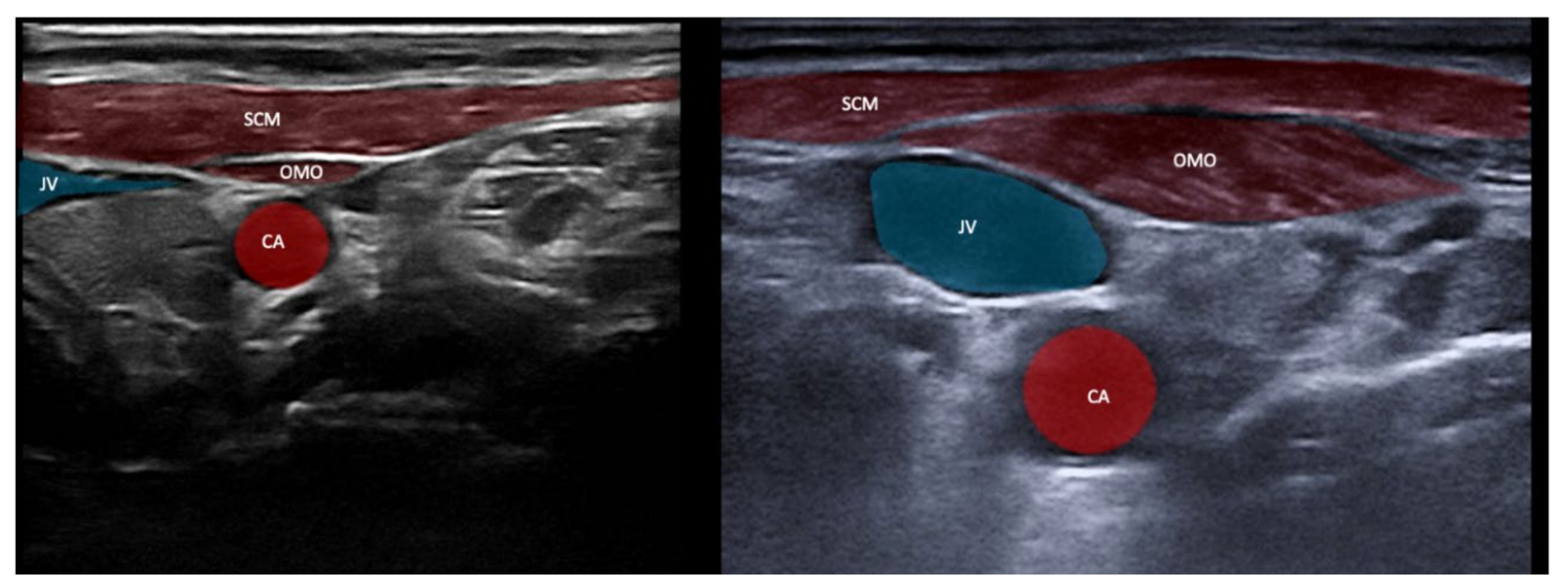 Toxins 13 00365 g008
