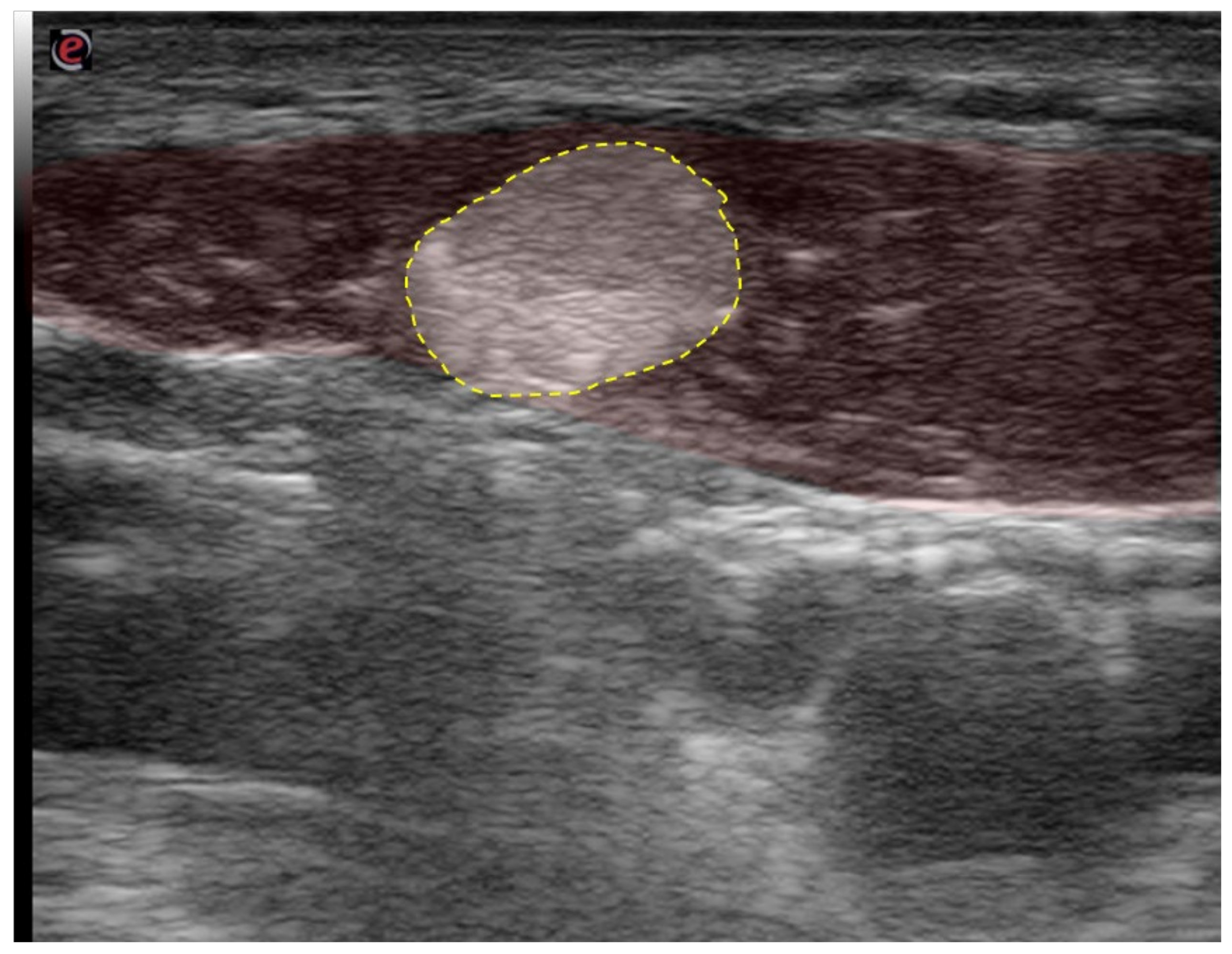 Toxins 13 00365 g009