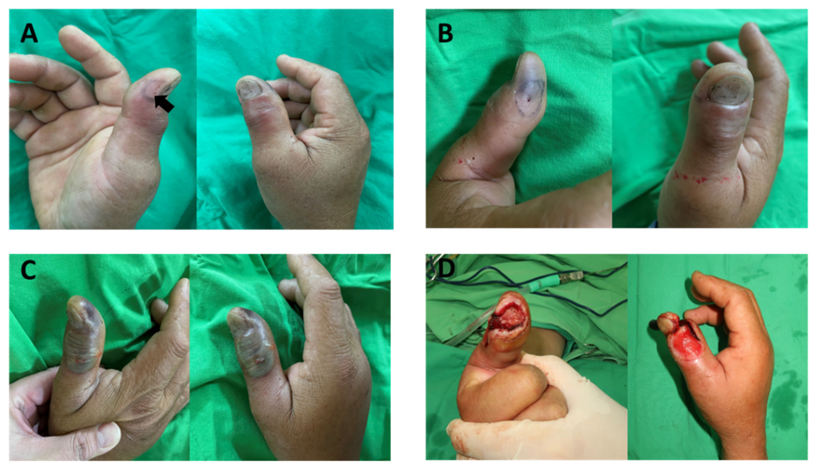 Toxins 13 00619 g001