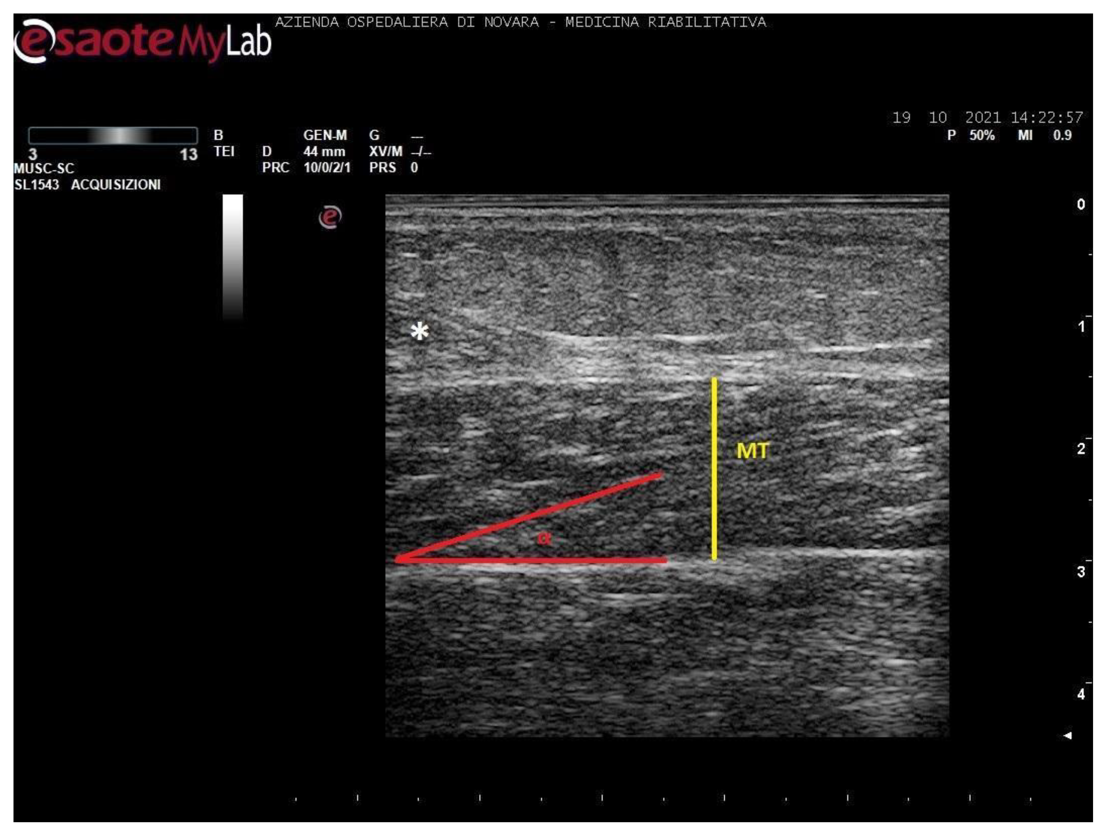 Toxins 13 00889 g004