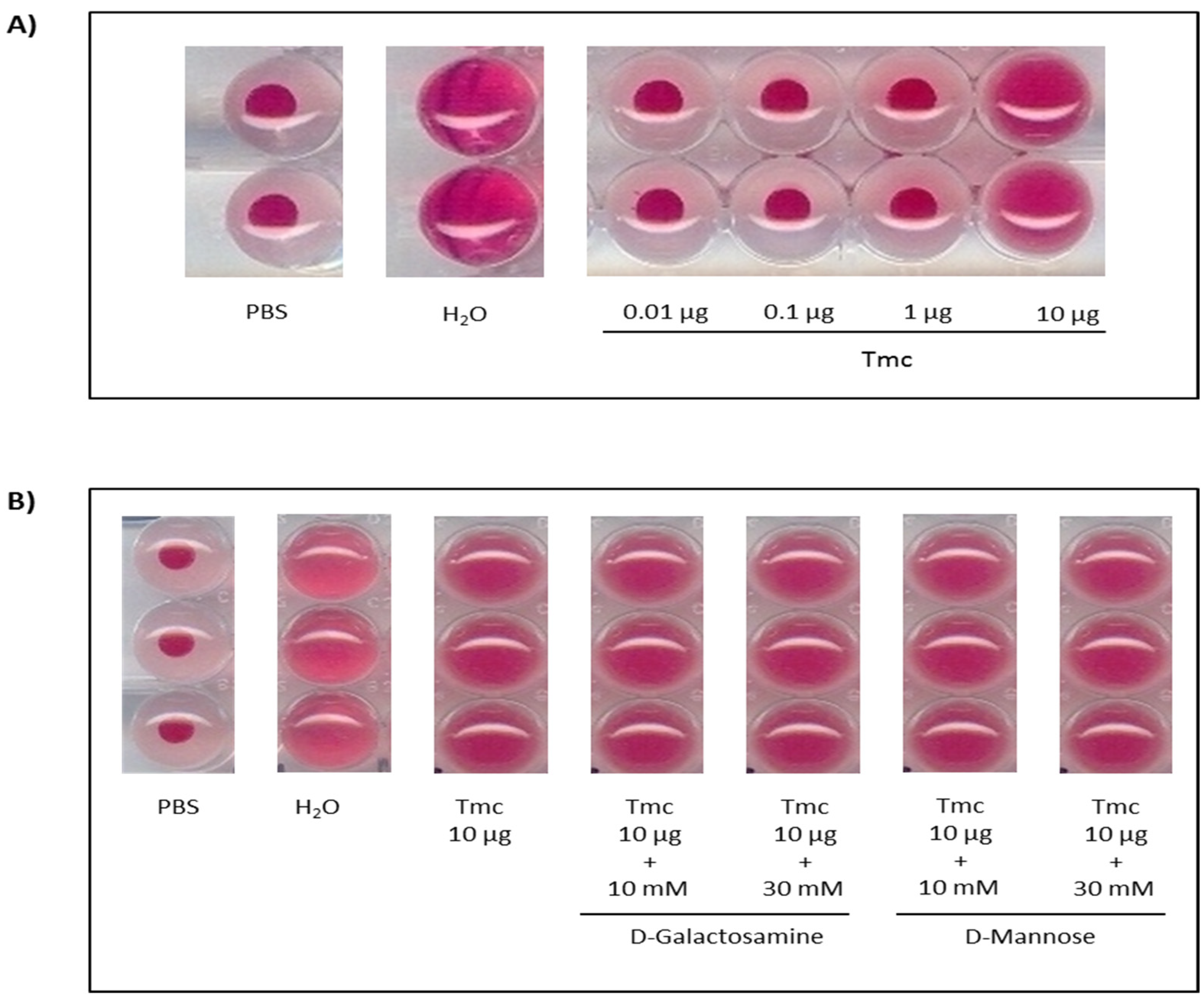Toxins 14 00002 g004