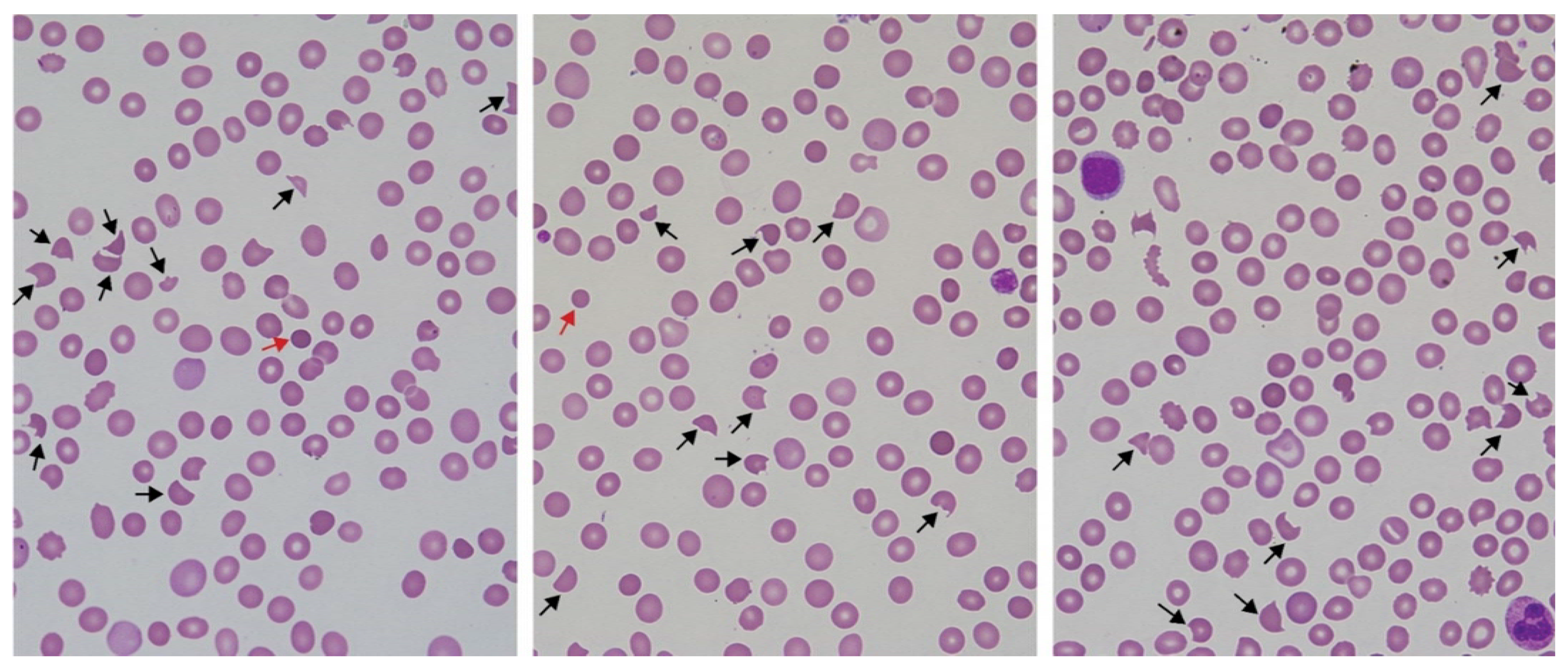 Toxins 14 00057 g002 Toxins 14 00057 g002