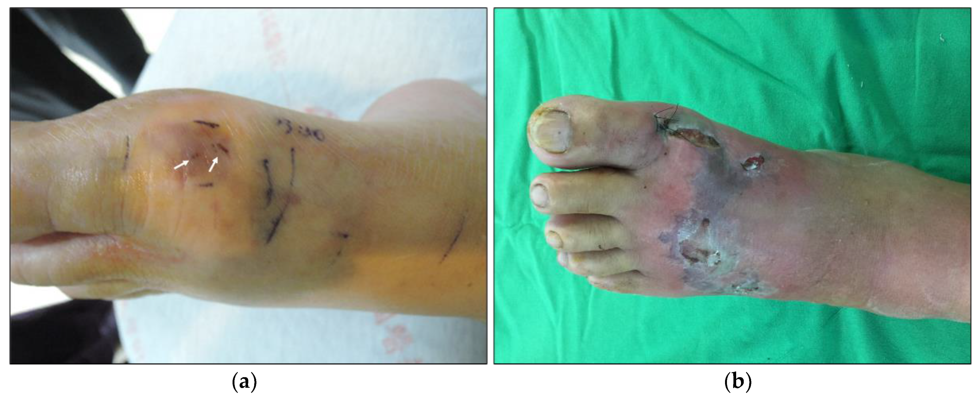 Toxins 14 00122 g001