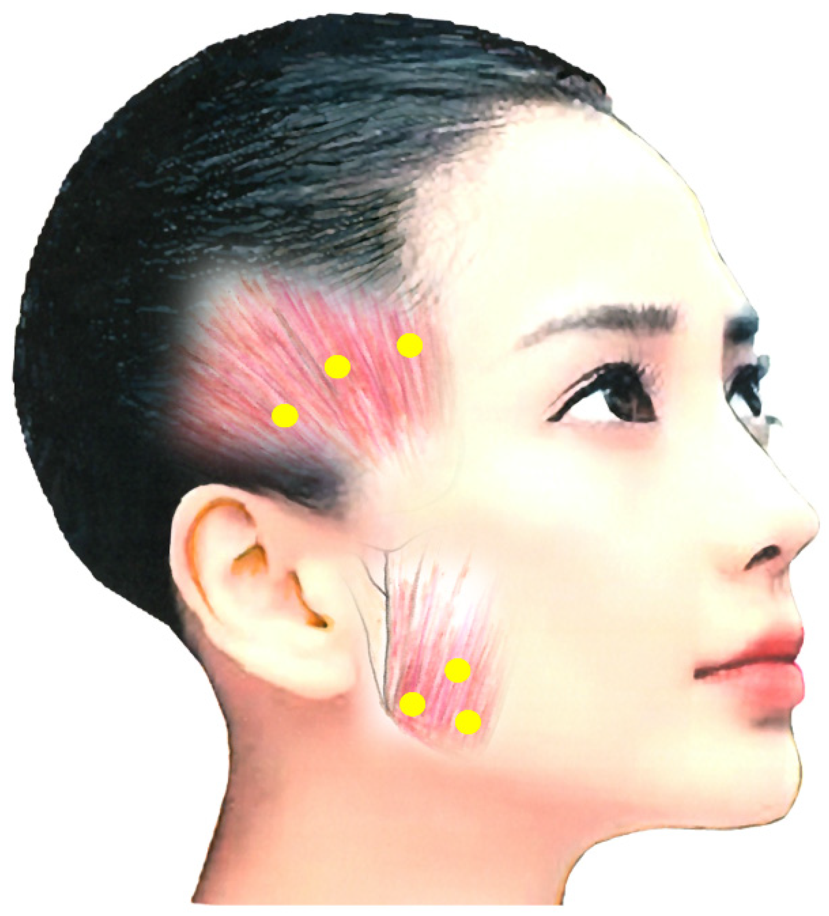 Toxins 14 00282 g001 Toxins 14 00282 g001