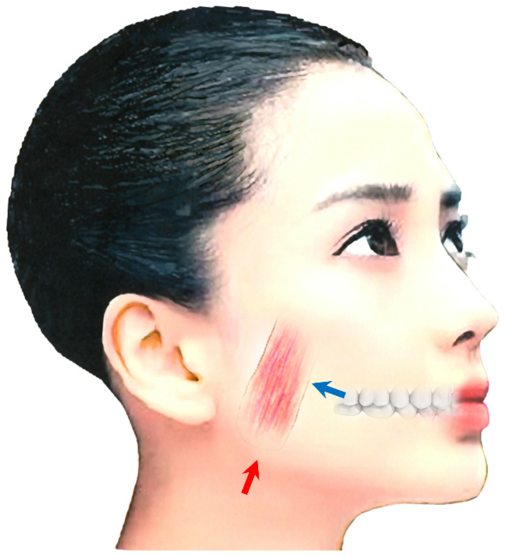 Toxins 14 00282 g002 Toxins 14 00282 g002