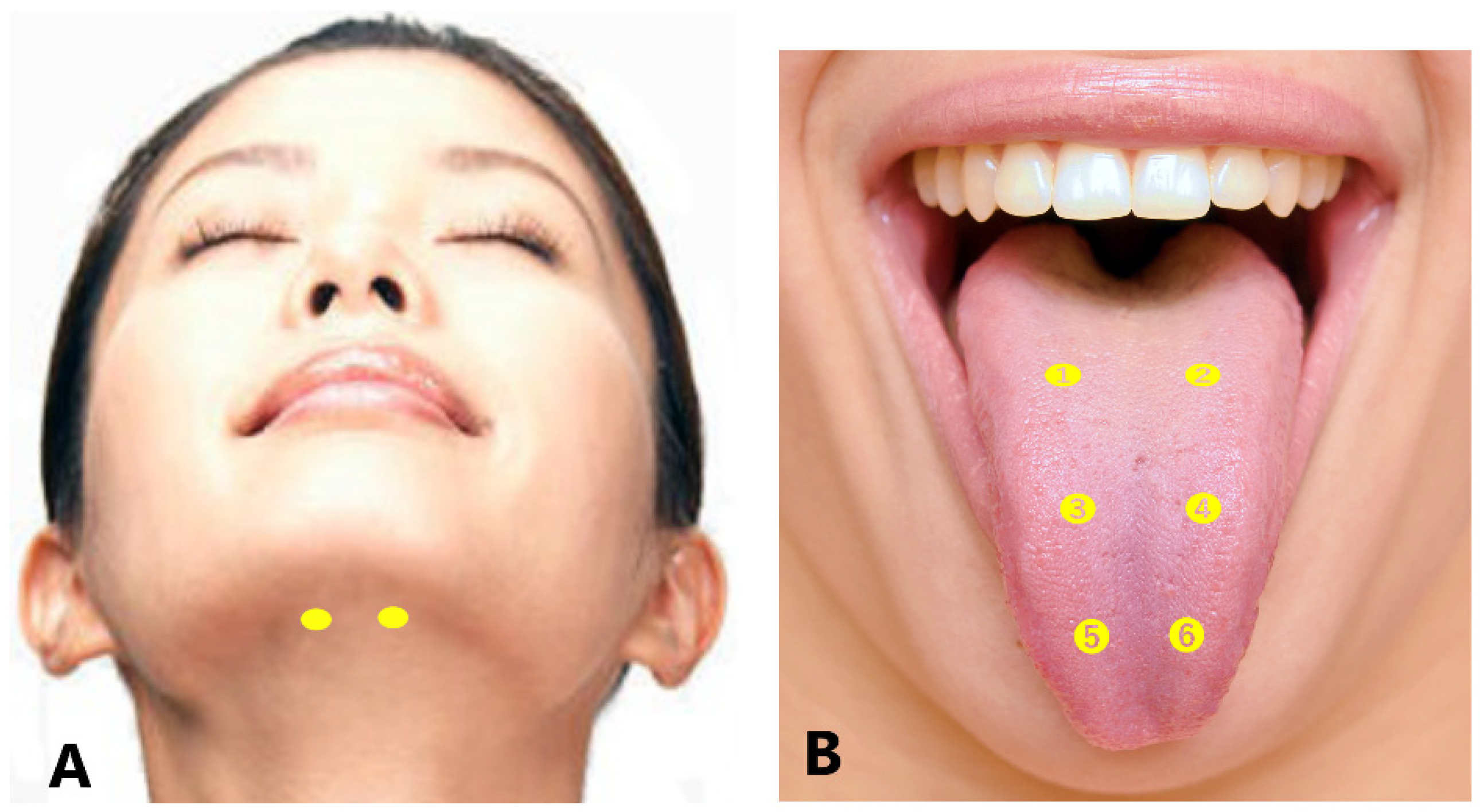 Toxins 14 00282 g004 Toxins 14 00282 g004