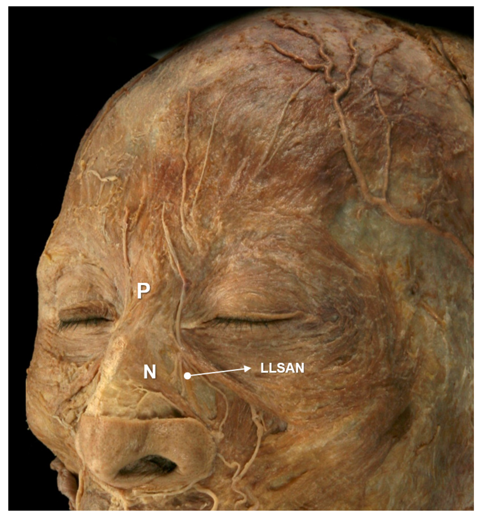 Toxins 14 00342 g004