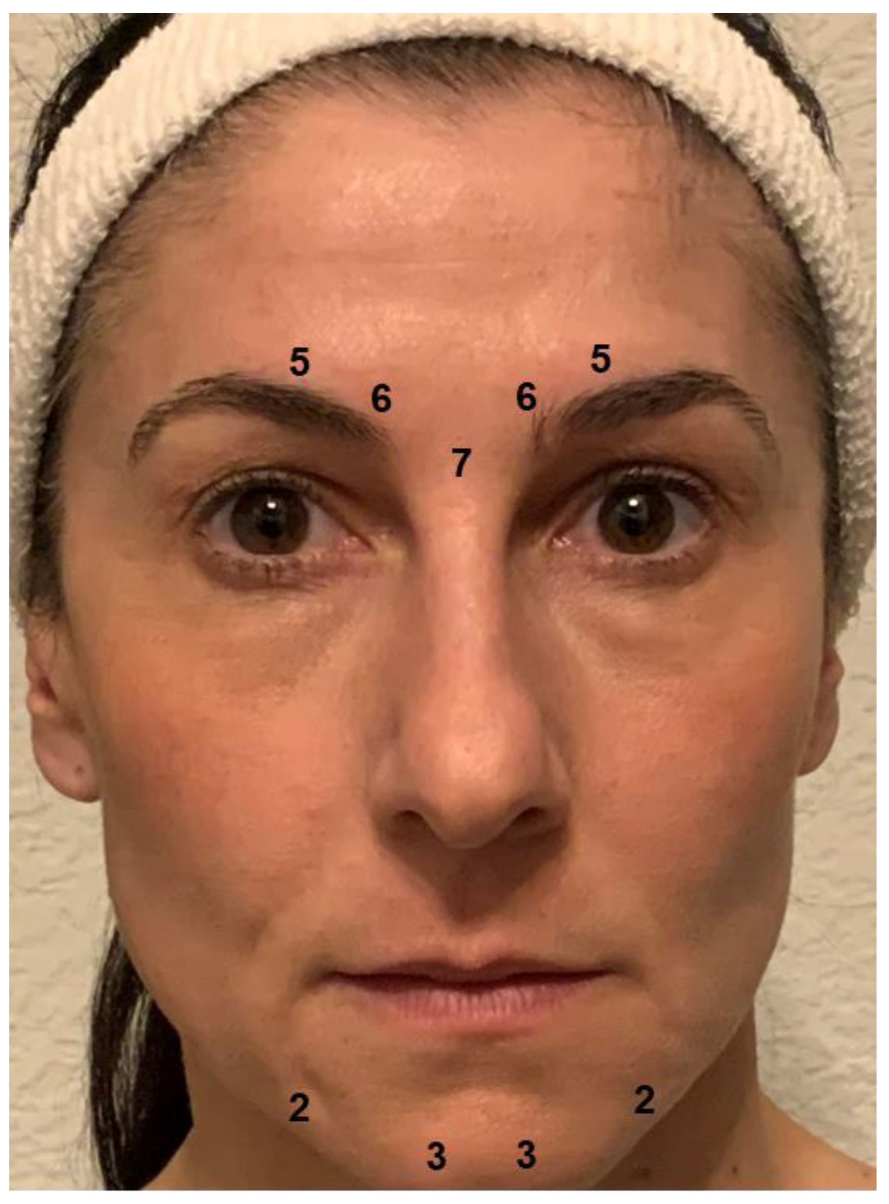 Toxins 14 00383 g002