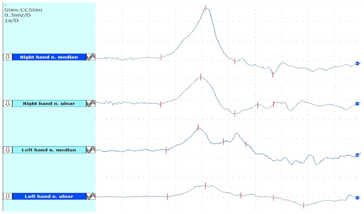 Toxins 14 00411 g003