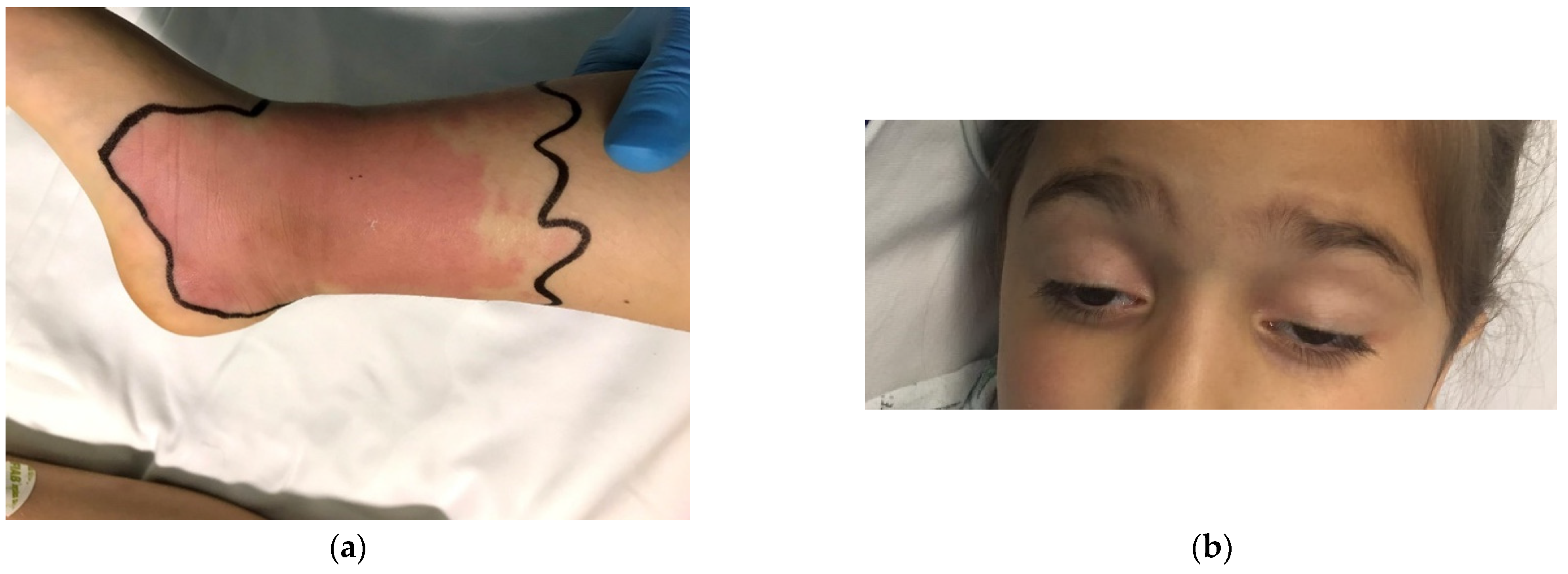 Toxins 14 00500 g001