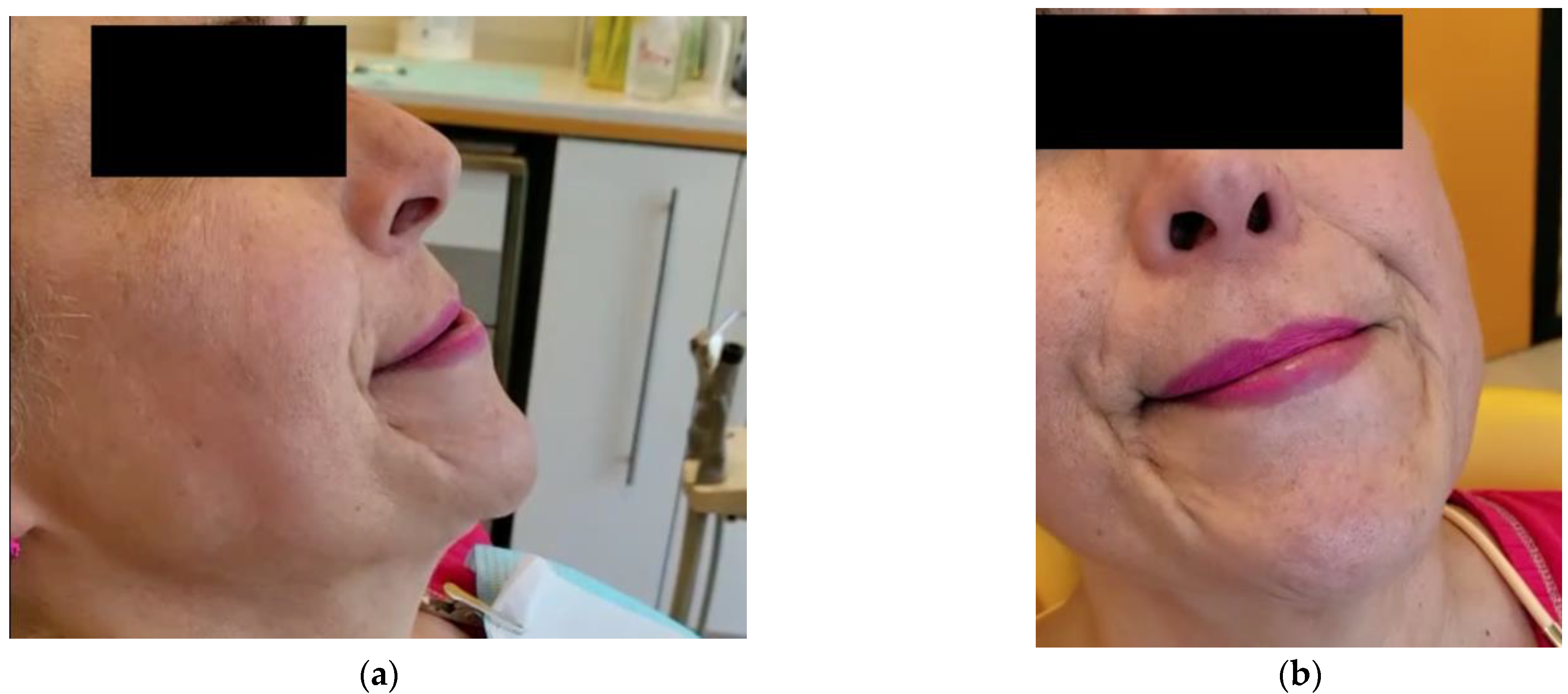 Toxins 14 00680 g001