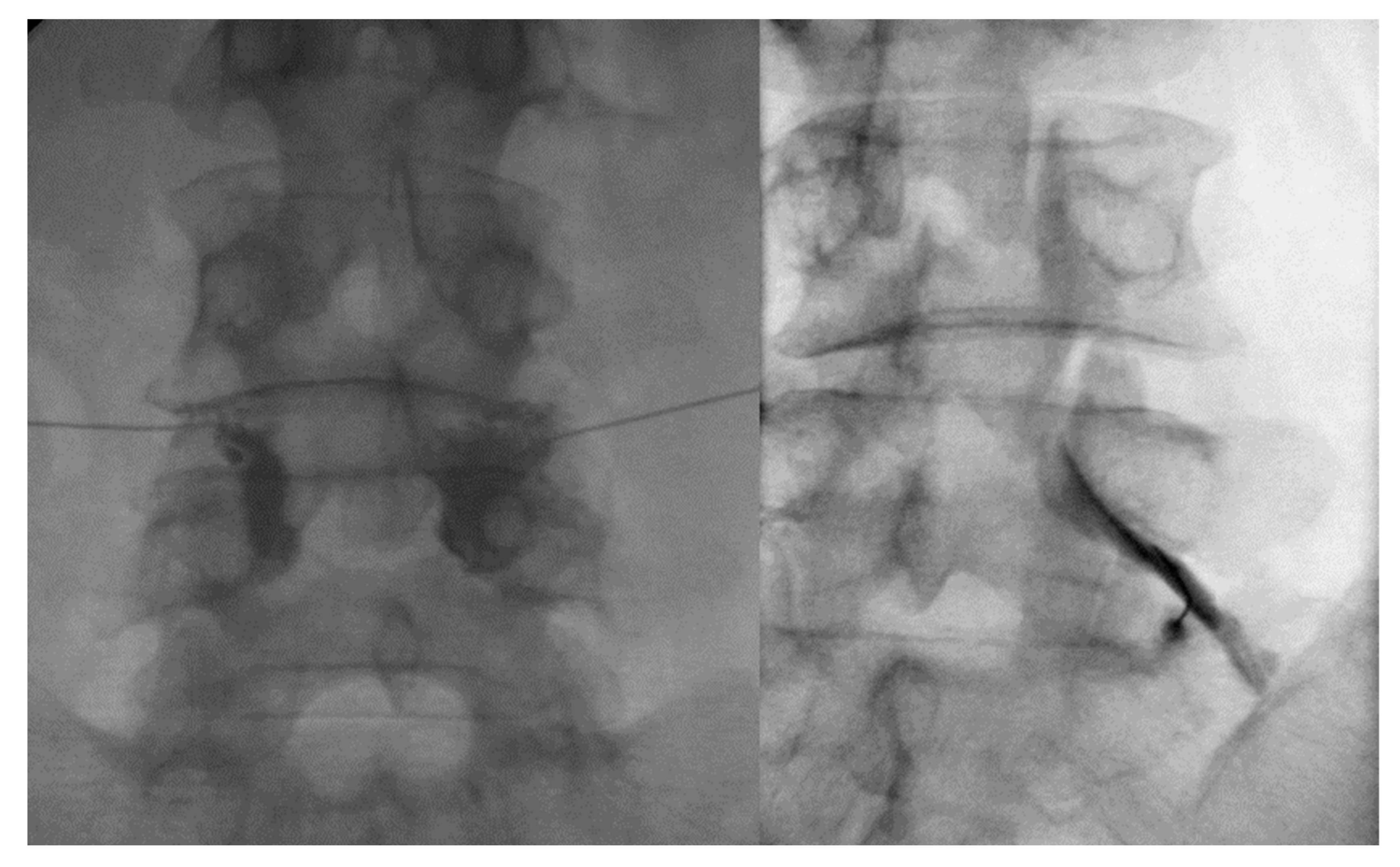 Toxins 15 00011 g004