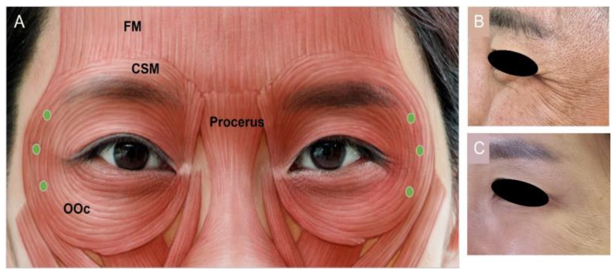 Toxins 15 00082 g003