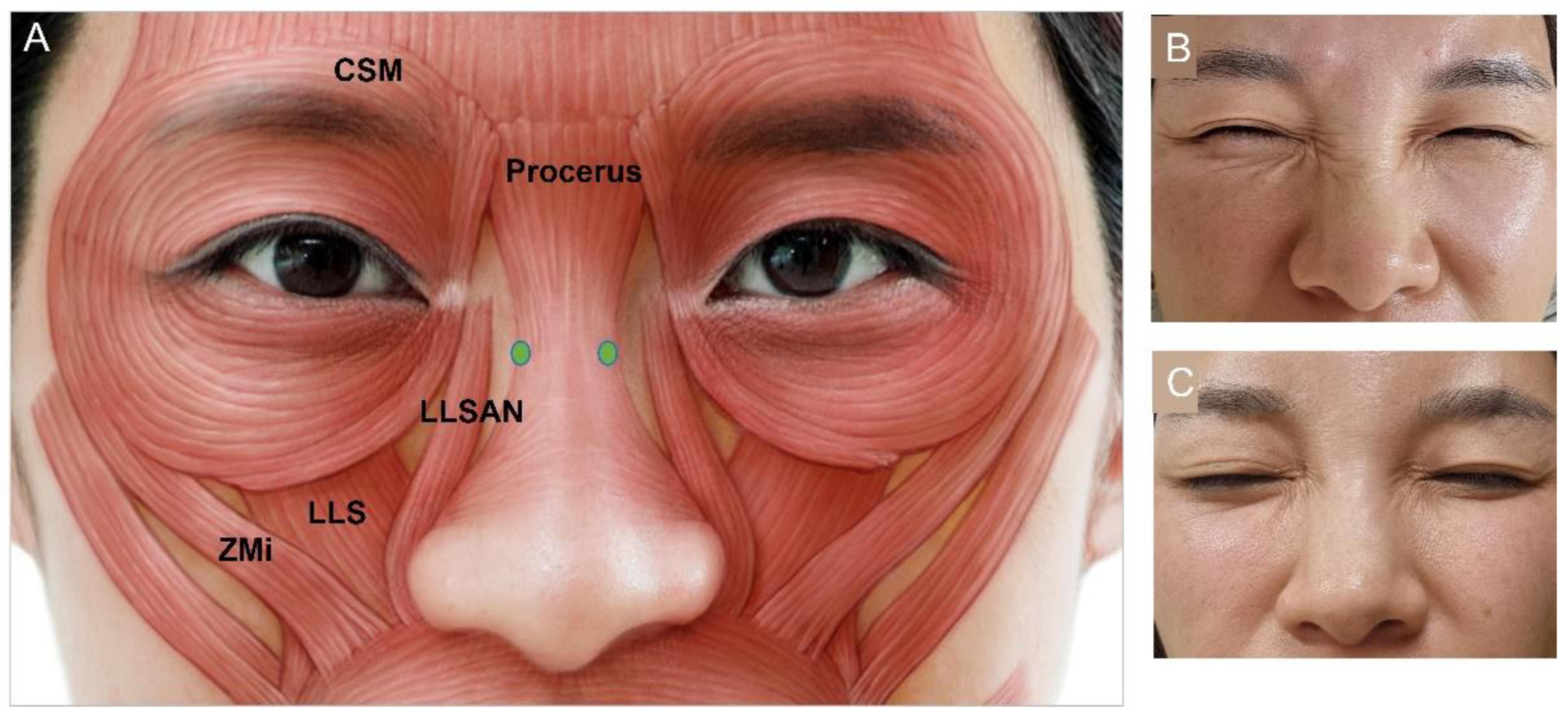 Toxins 15 00082 g005