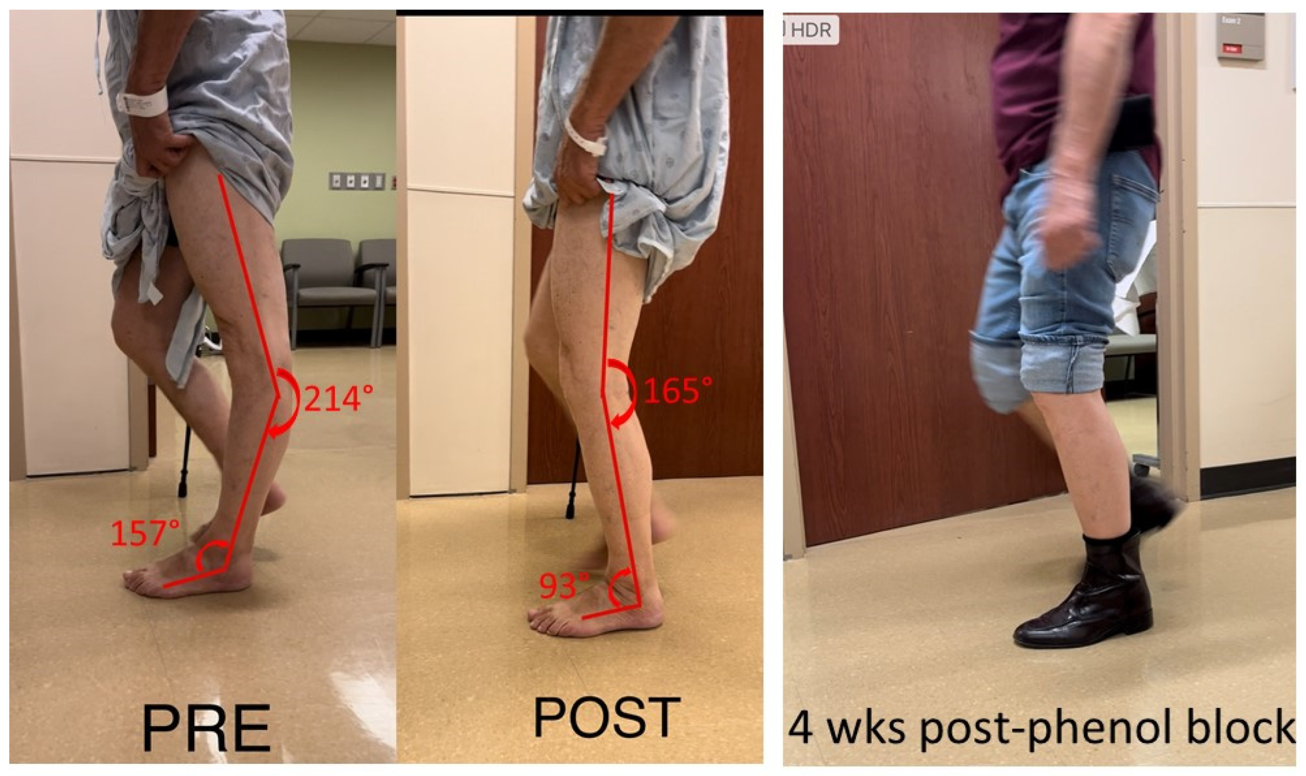 Toxins 15 00204 g001
