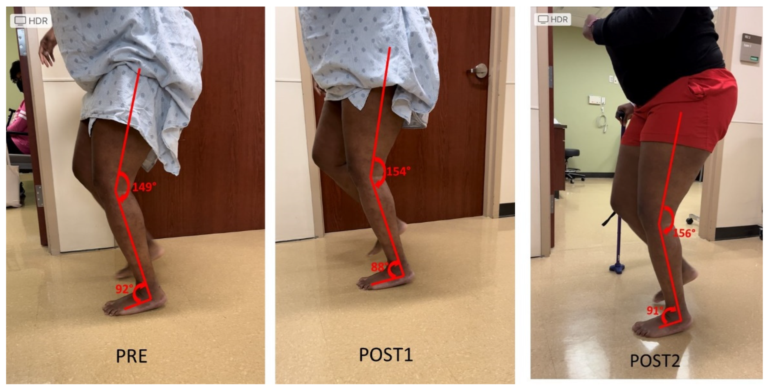 Toxins 15 00204 g003