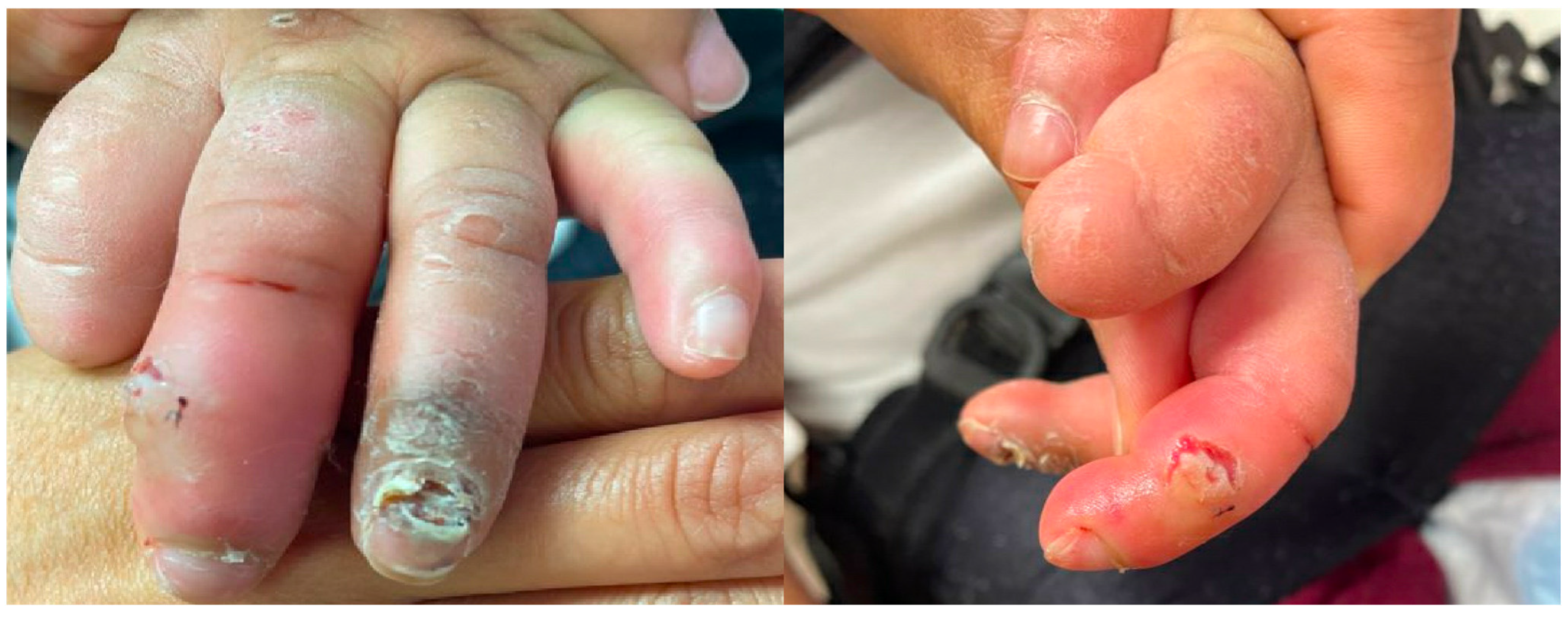 Toxins 15 00236 g003